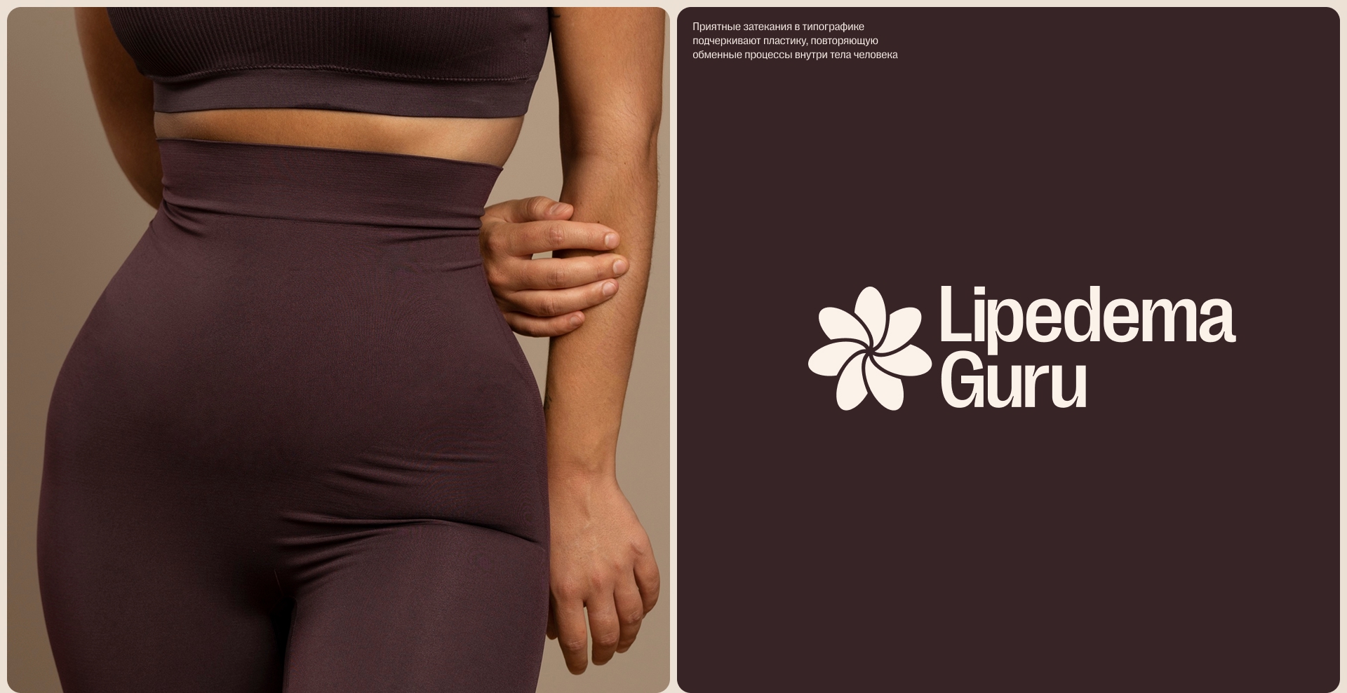 Lipedema Guru — Изображение №5 — Интерфейсы, Брендинг на Dprofile