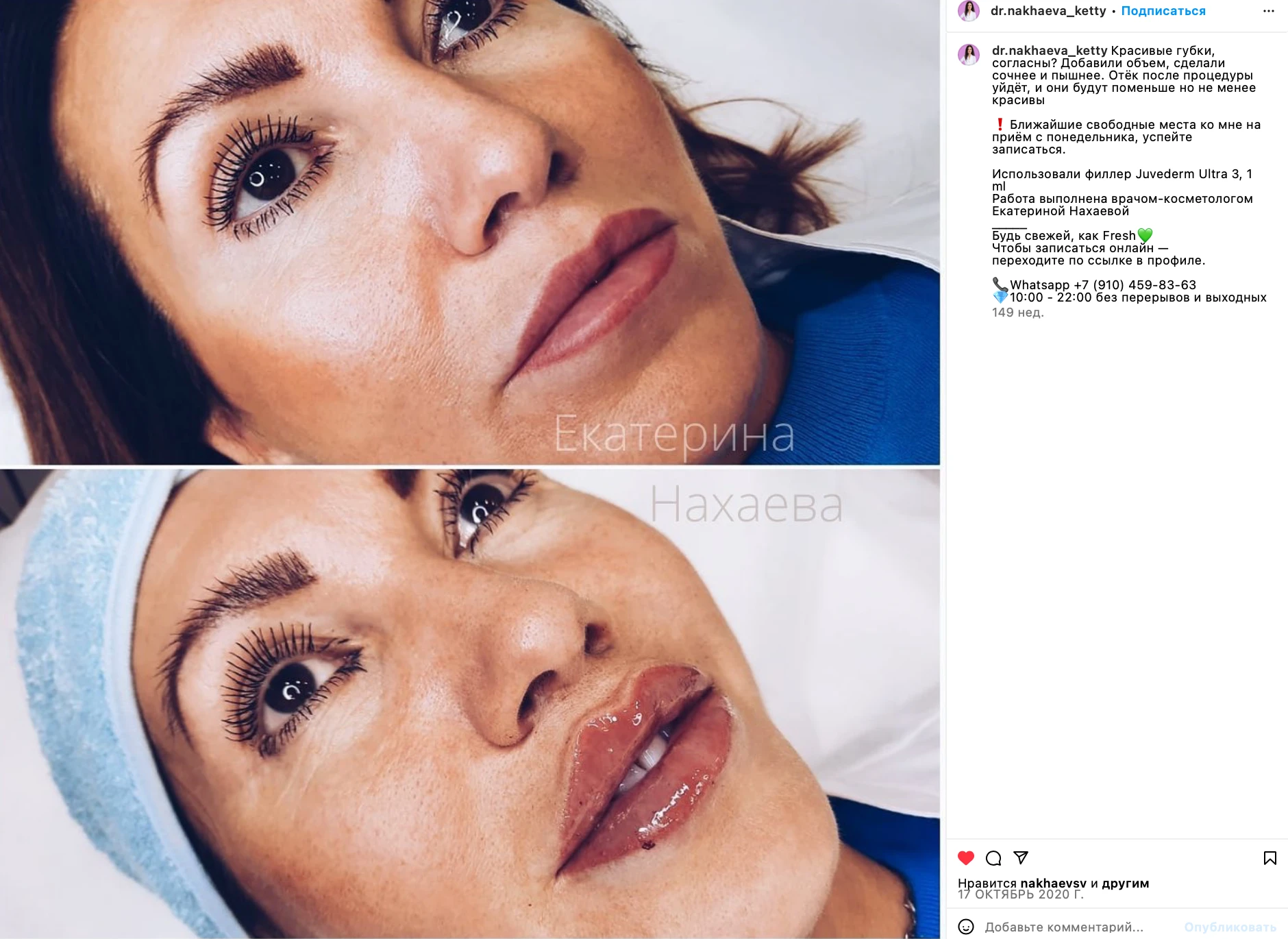 SMM / DESIGN / COPYWRITING / COSMETOLOGY CENTER — Изображение №7 — Графика, Маркетинг на Dprofile