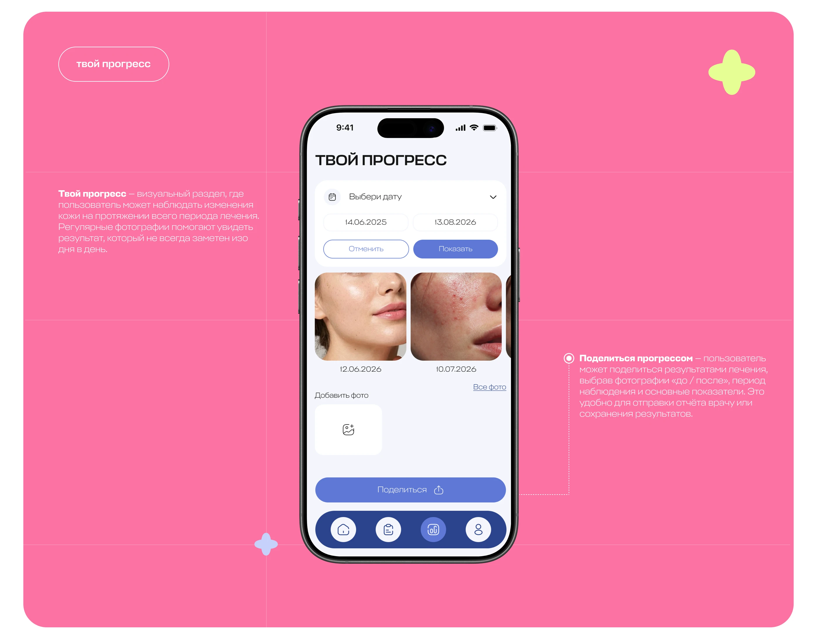SkinTrack | Mobile app for personalized skincare — Изображение №16 — Интерфейсы, Нейро на Dprofile
