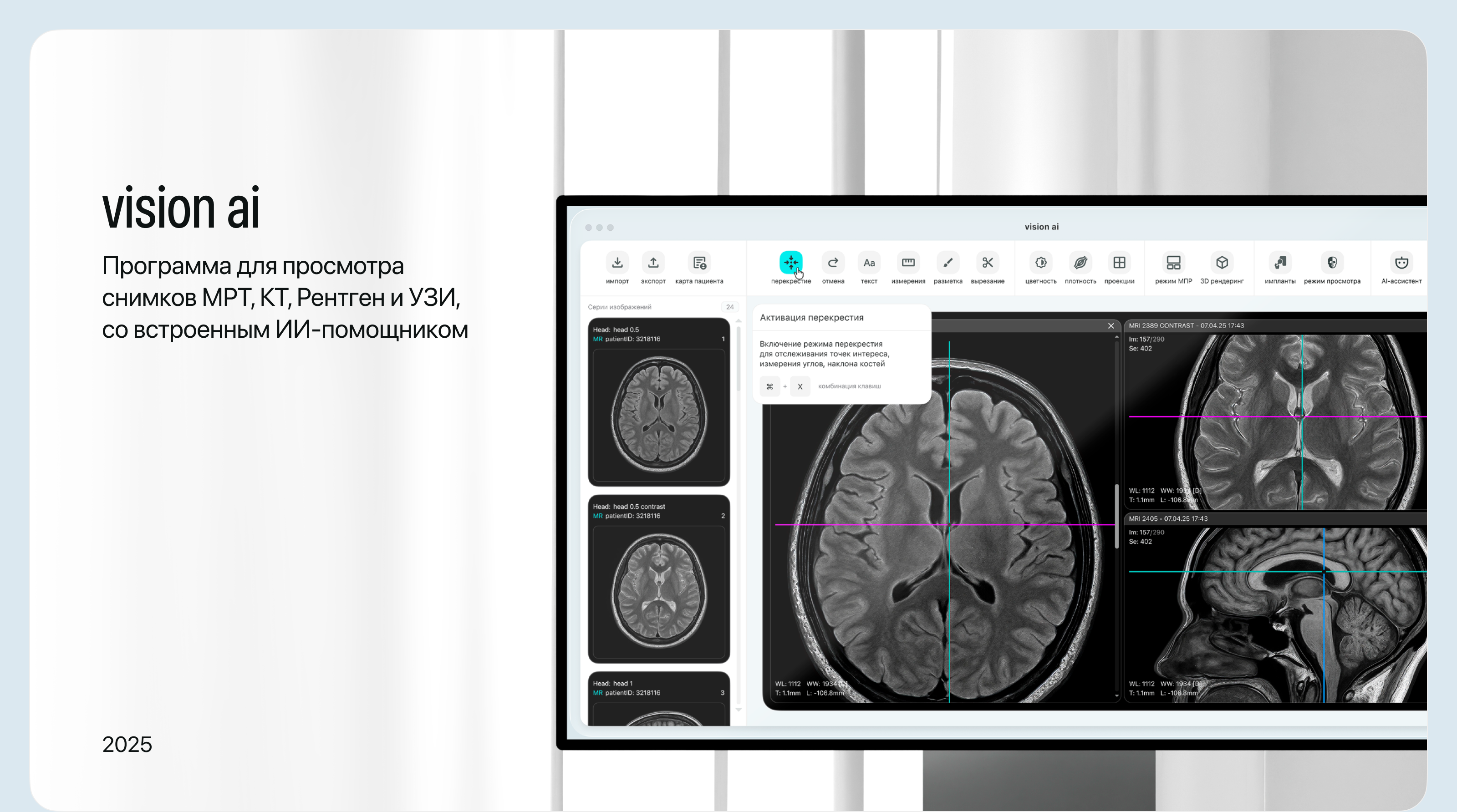 vision ai — Изображение №1 — Интерфейсы на Dprofile