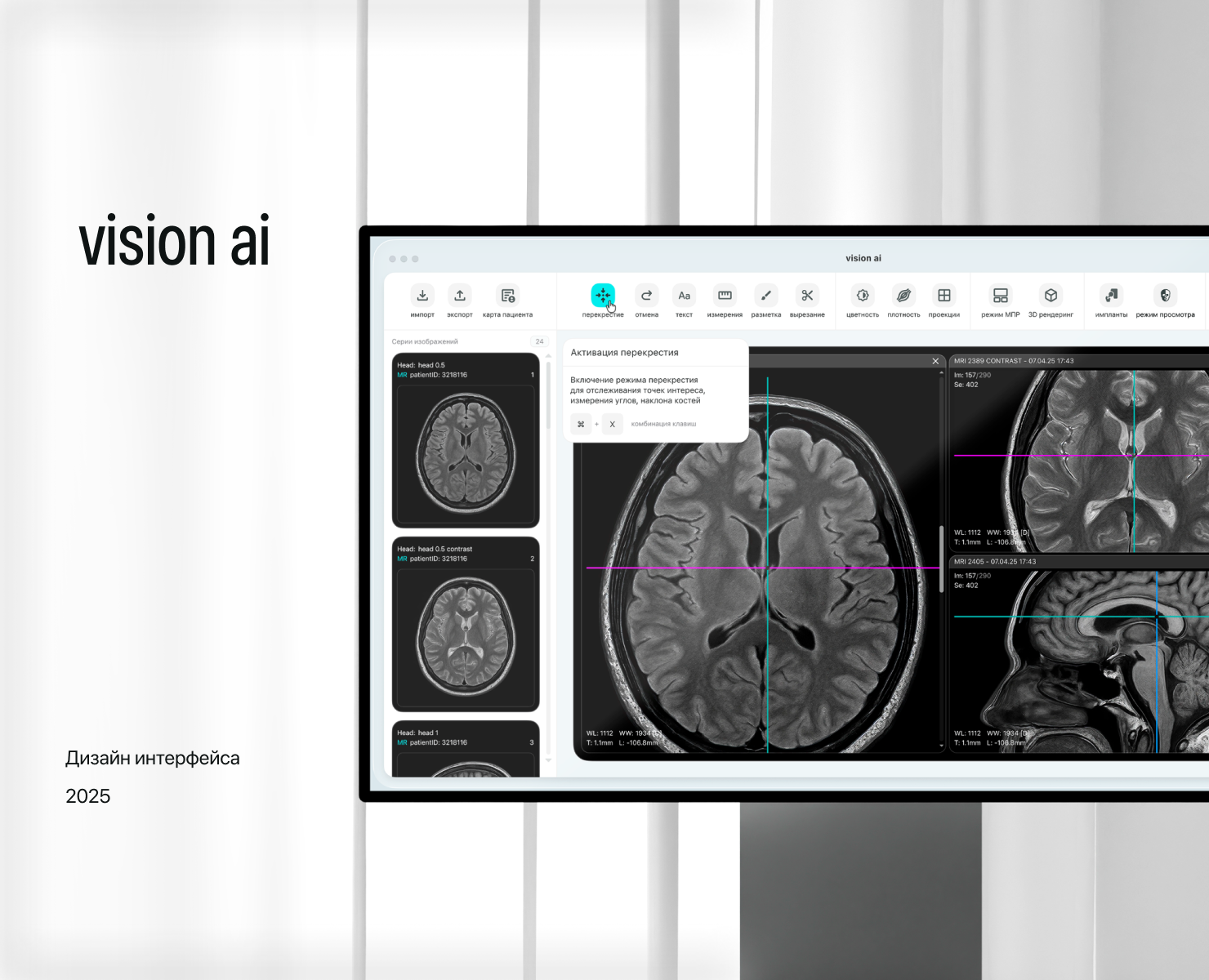 vision ai на Dprofile