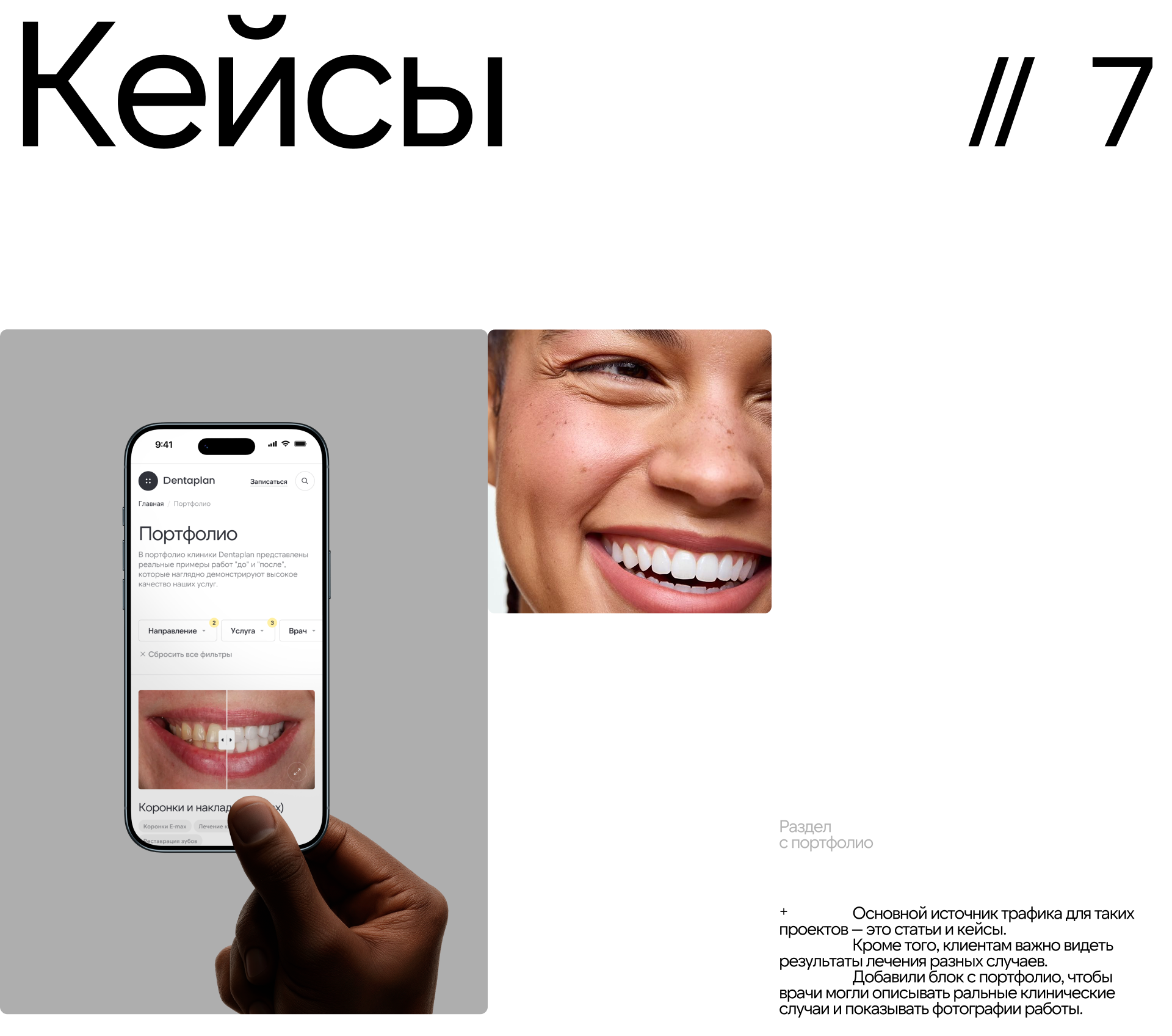 Dentaplan — Редизайн сайта стоматологической клиники — Изображение №15 — Интерфейсы на Dprofile