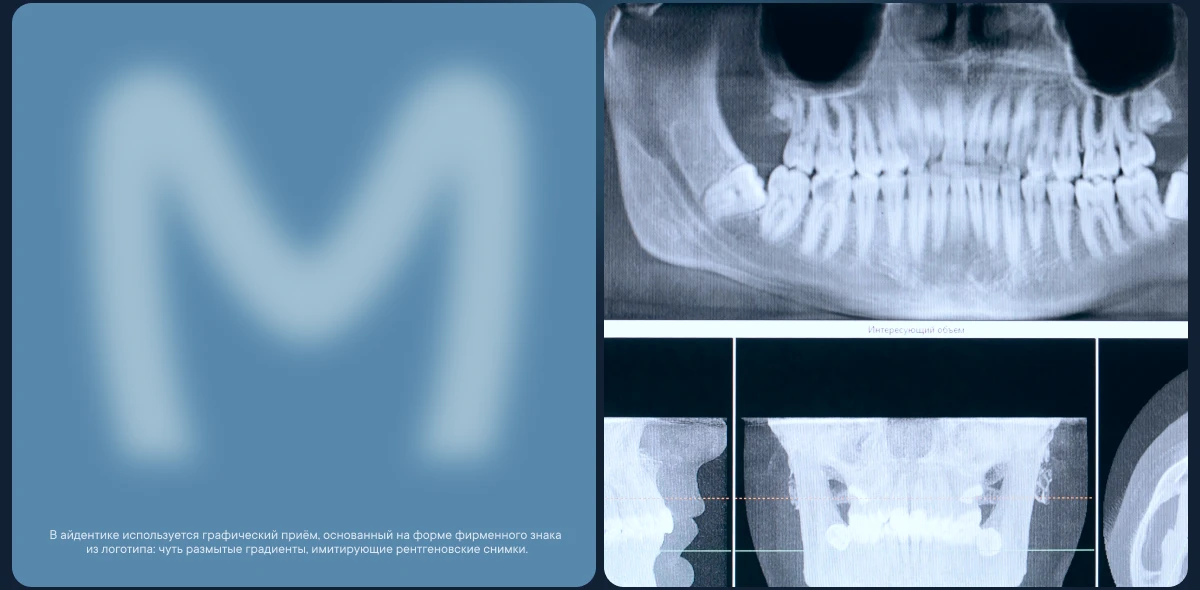 La Primera айдентика для стоматологической клиники — Изображение №6 — Брендинг на Dprofile
