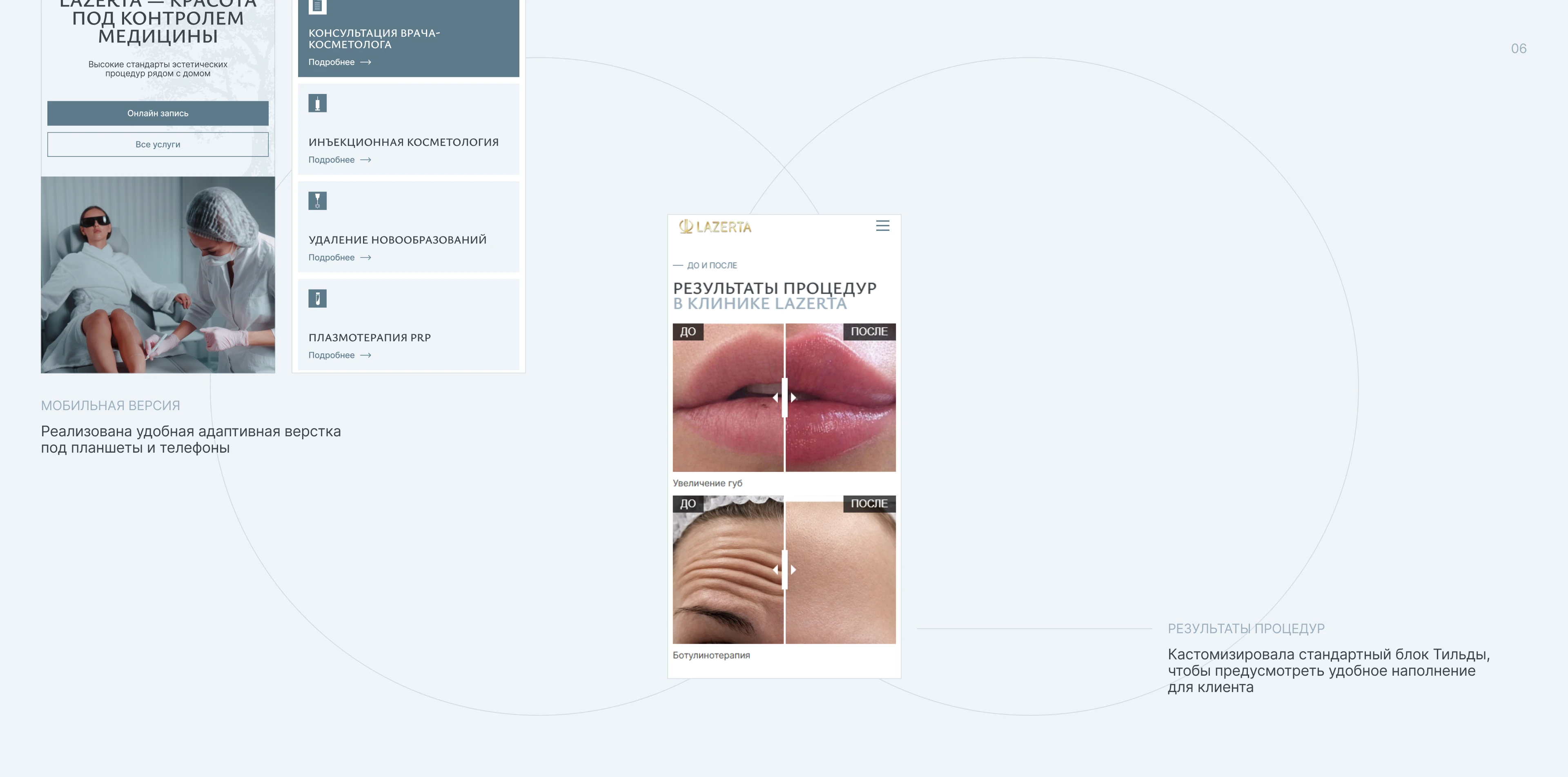 Сайт для косметологической клиники // Website Design — Изображение №7 — Интерфейсы на Dprofile