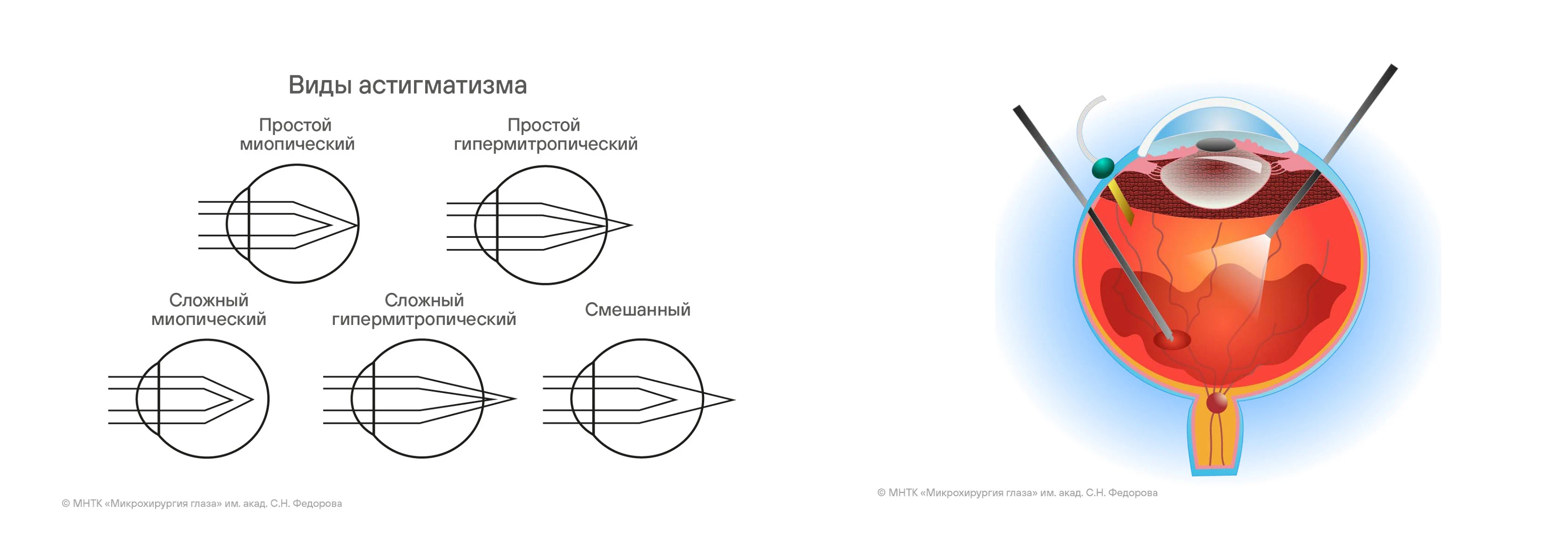 Мир офтальмологии — Изображение №19 — Брендинг, Иллюстрация на Dprofile