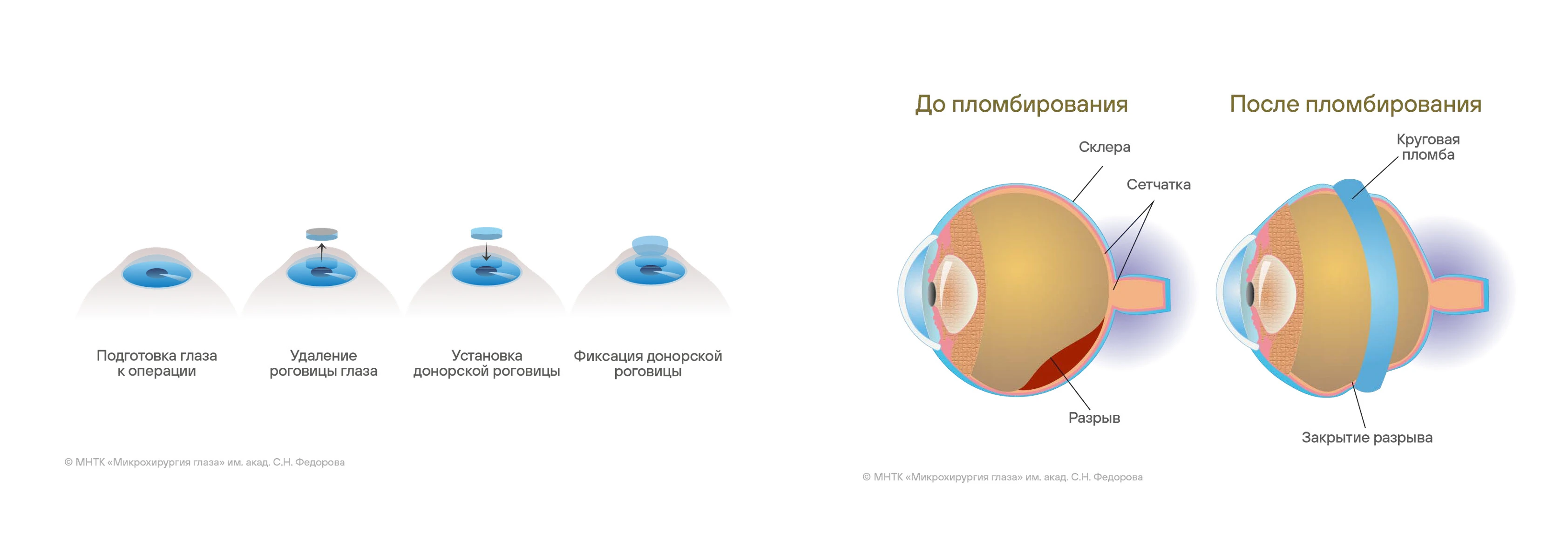 Мир офтальмологии — Изображение №20 — Брендинг, Иллюстрация на Dprofile
