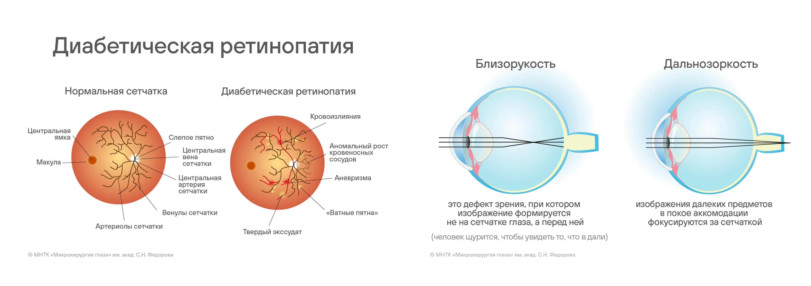 Мир офтальмологии — Изображение №21 — Брендинг, Иллюстрация на Dprofile