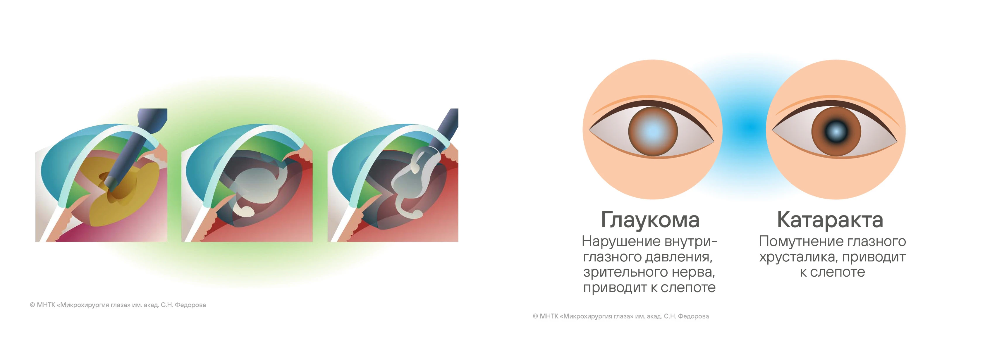 Мир офтальмологии — Изображение №16 — Брендинг, Иллюстрация на Dprofile