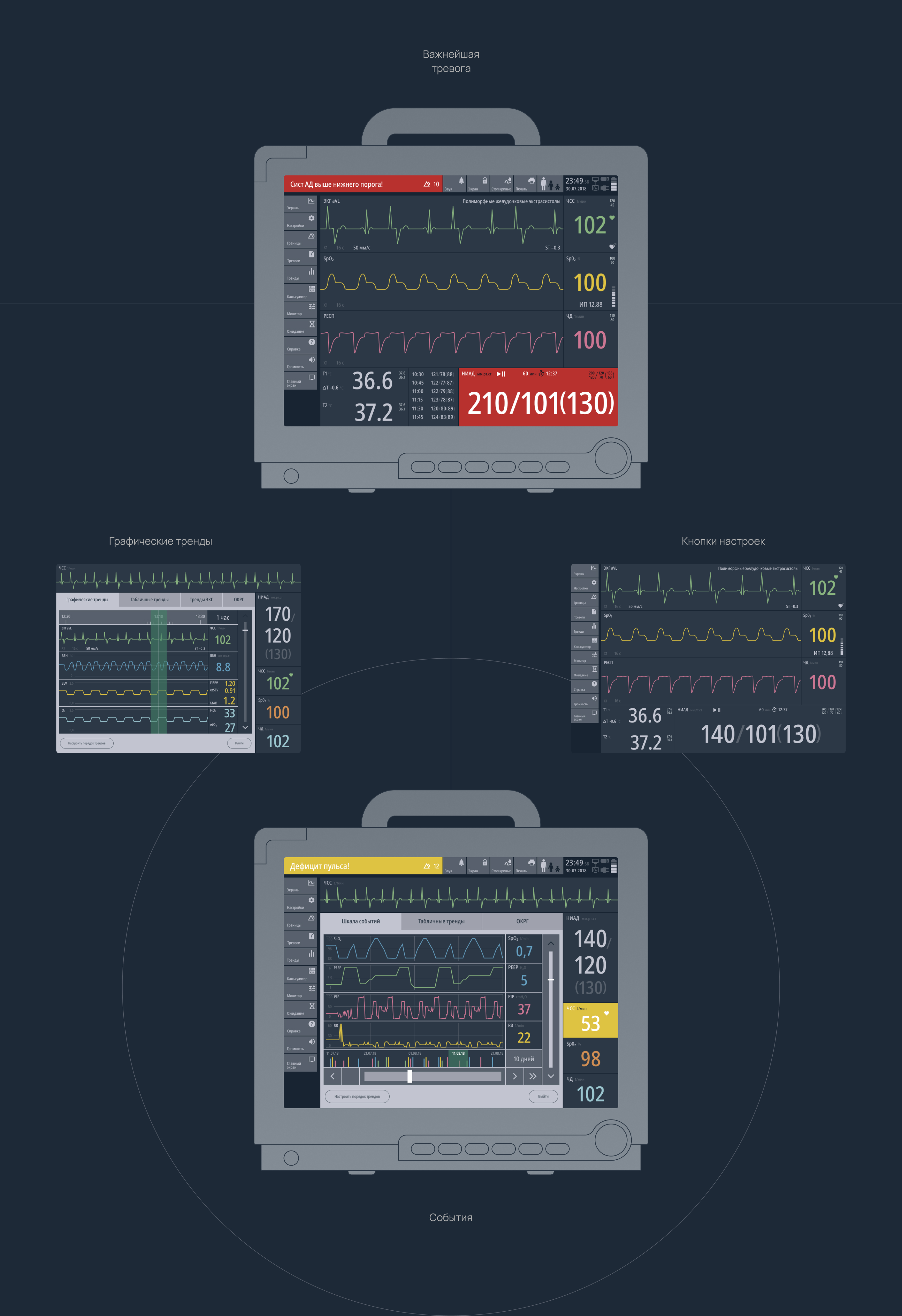 Монитор пациентов — Изображение №4 — Интерфейсы на Dprofile