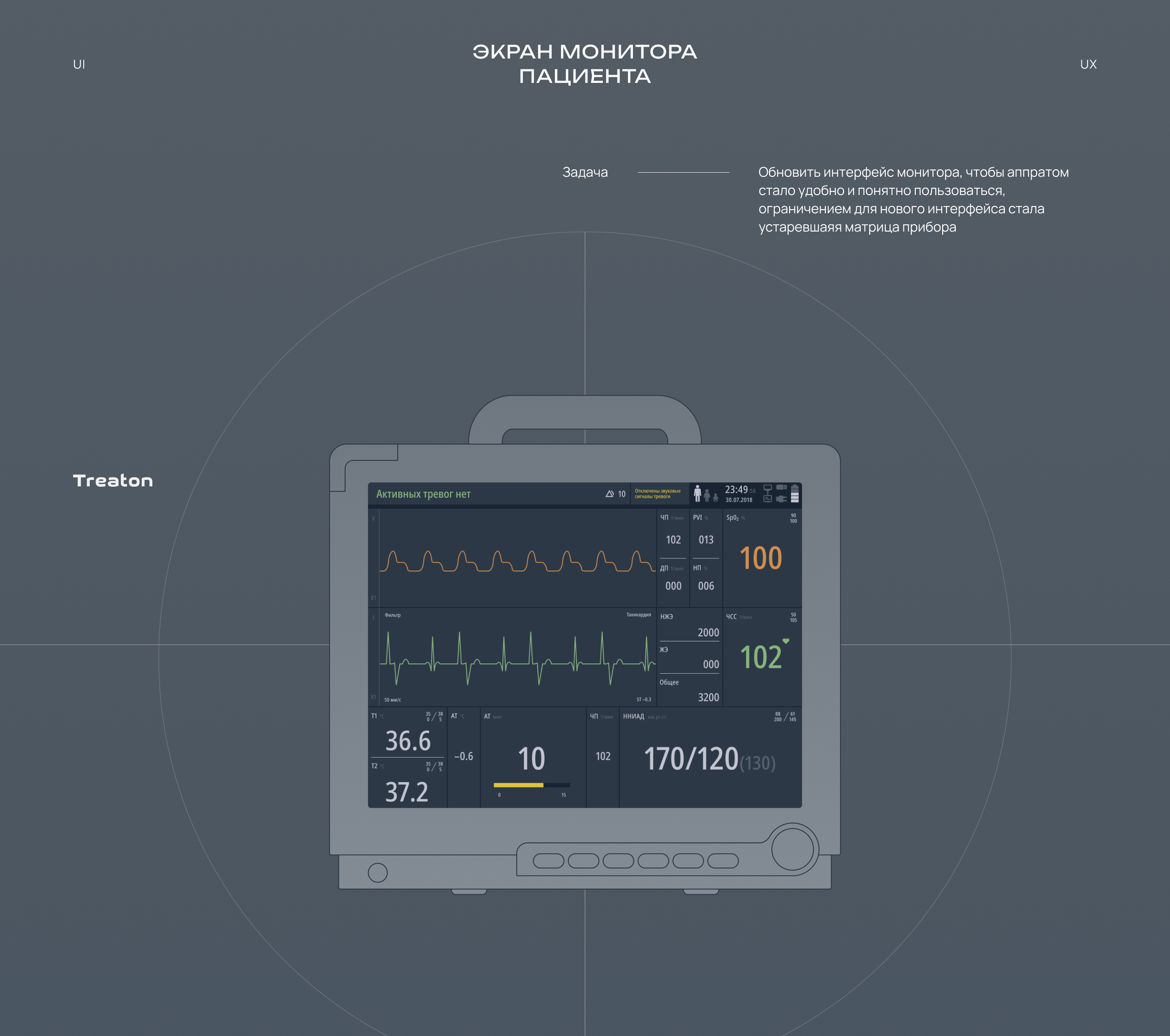 Монитор пациентов — Изображение №1 — Интерфейсы на Dprofile