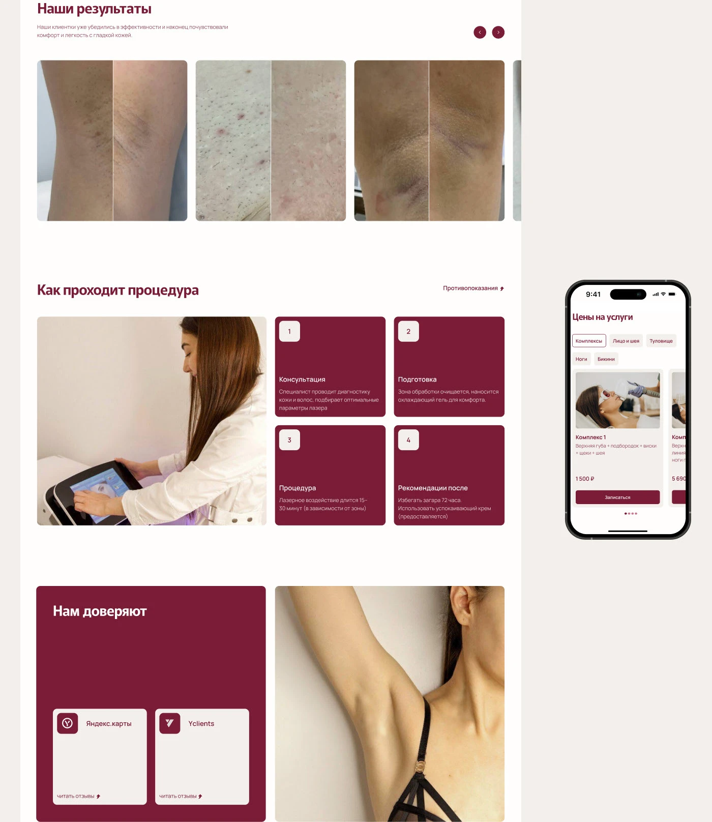 Лендинг для студии лазерной эпиляции — Изображение №12 — Интерфейсы на Dprofile
