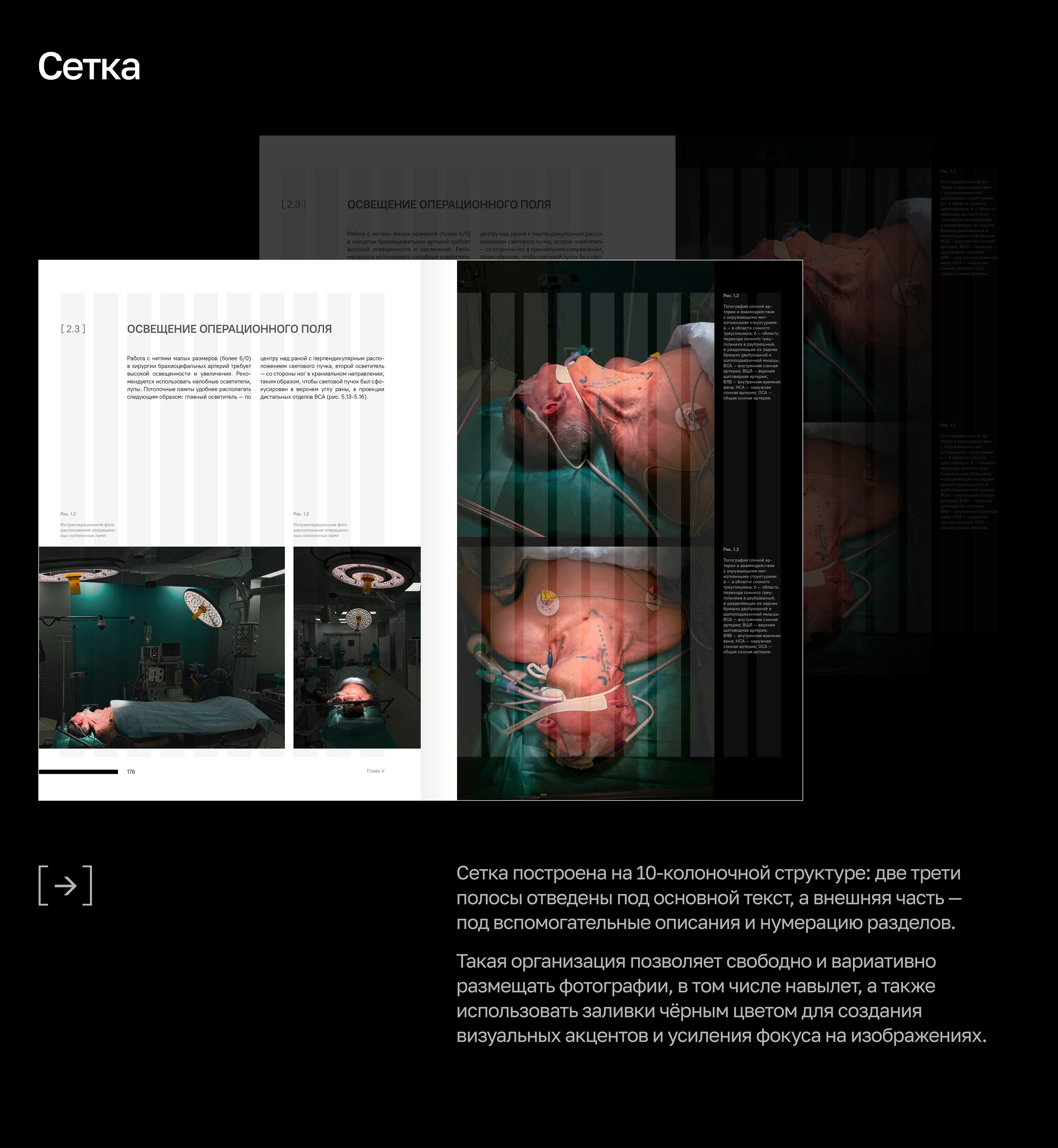 Хирургический фотоатлас | НМИЦО ФМБА России — Изображение №3 — Графика, Нейро на Dprofile