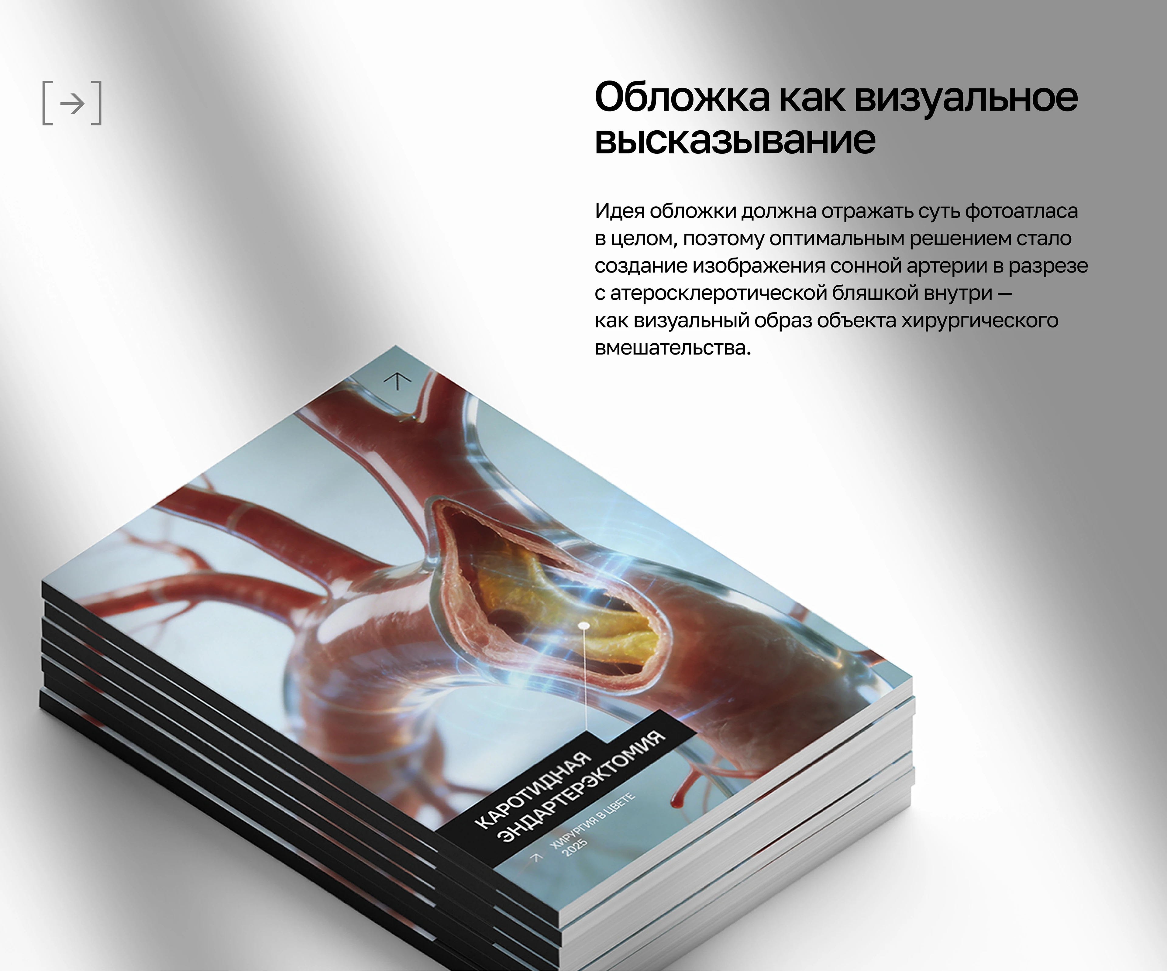Хирургический фотоатлас | НМИЦО ФМБА России — Изображение №8 — Графика, Нейро на Dprofile