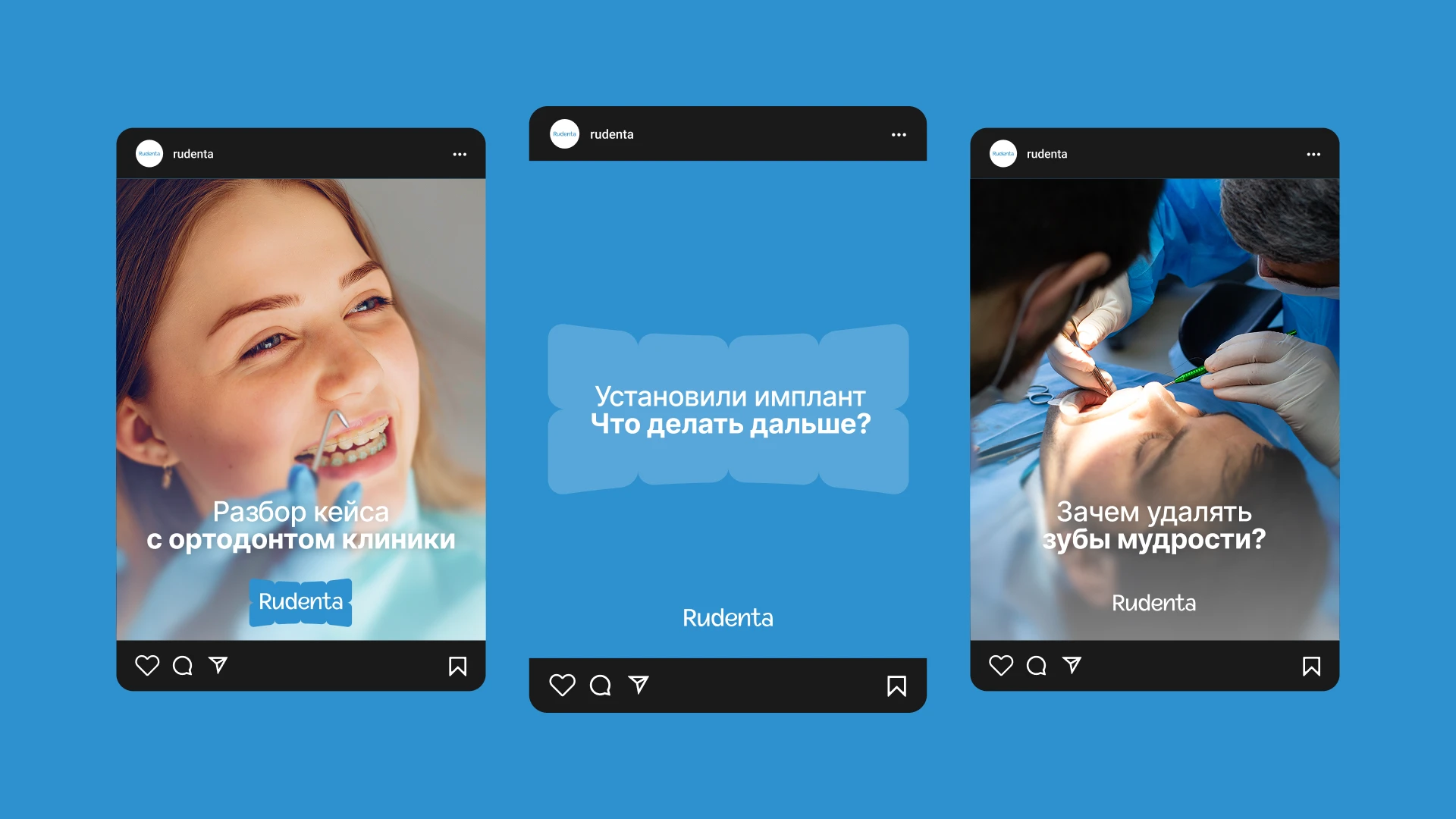 Концепция ребрендинга для стоматологии Rudenta — Изображение №12 — Брендинг на Dprofile