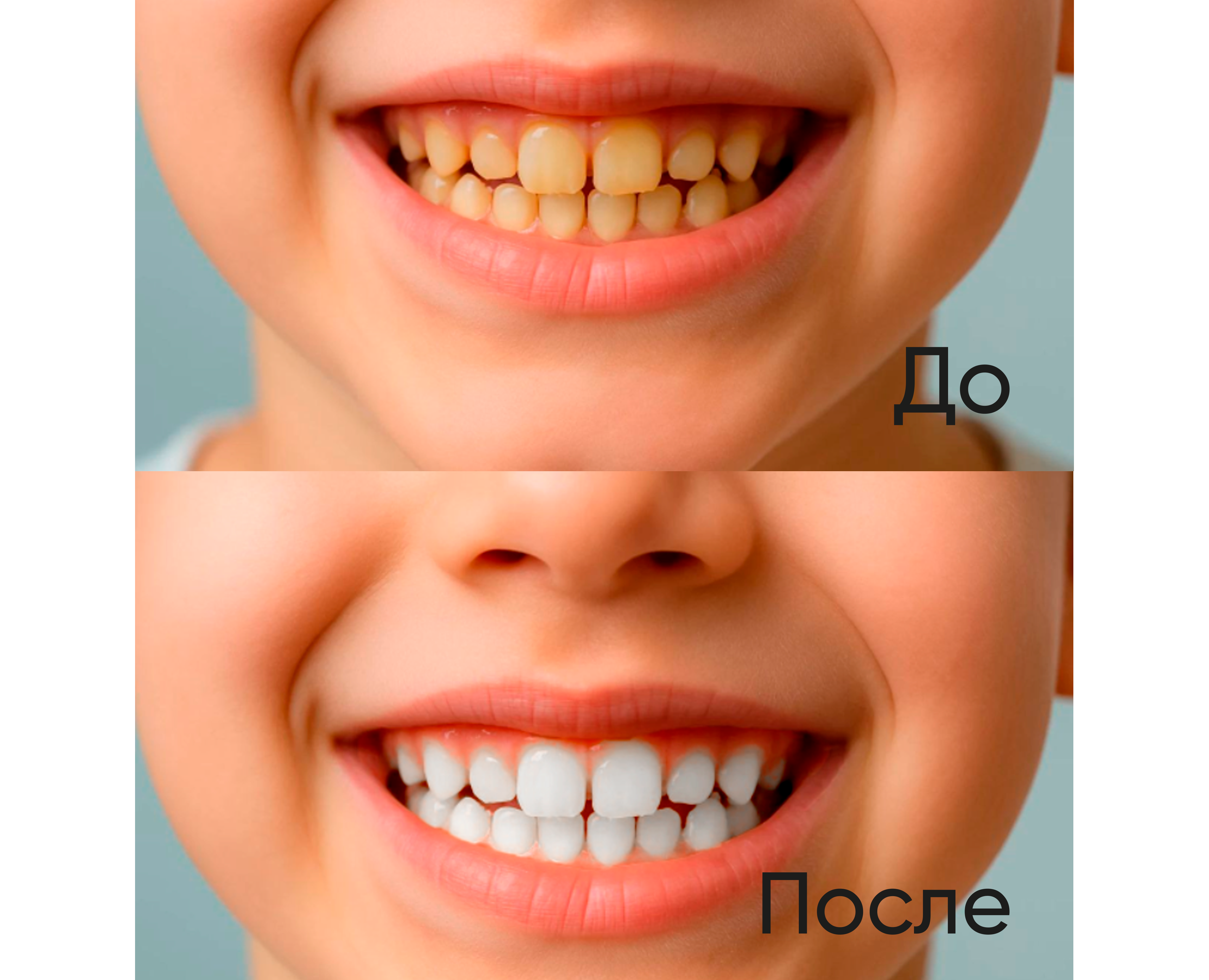 Осветлить зубы — Графика на Dprofile