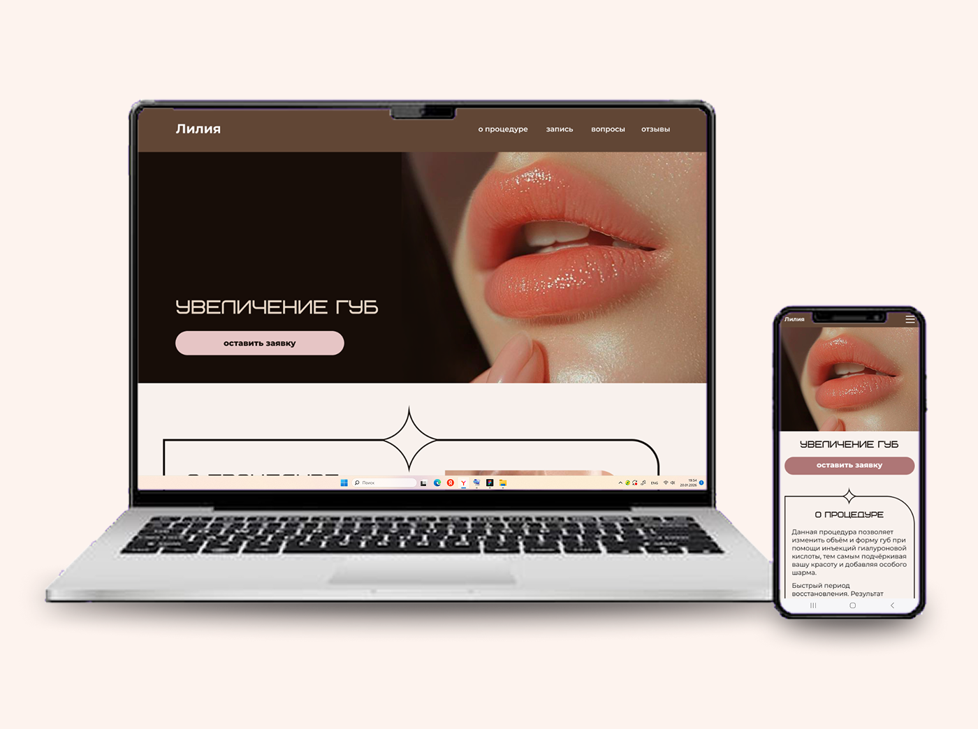 concept-дизайн лендинга: процедуры салона красоты — Изображение №5 — Интерфейсы, Брендинг на Dprofile