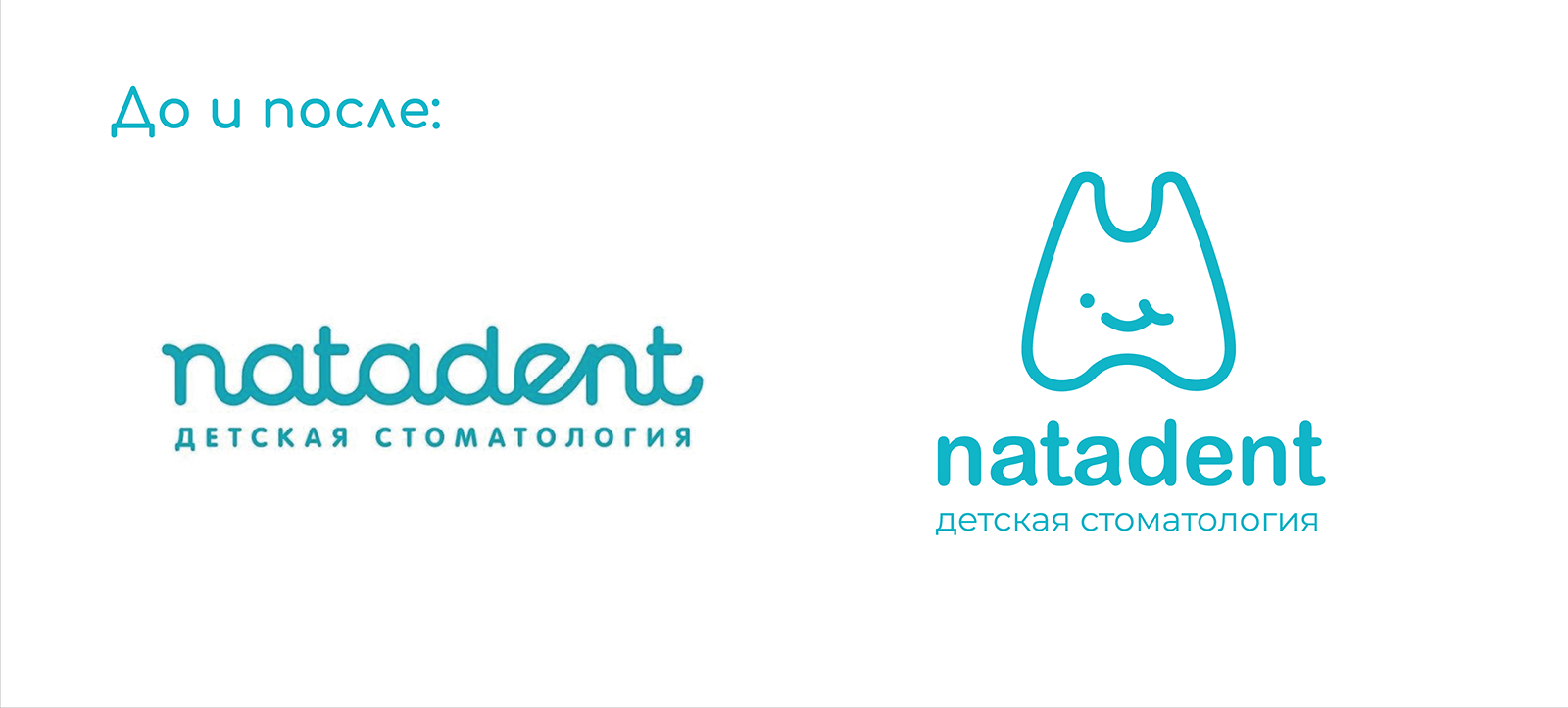 LOGO | STOMATOLOGY | NATADENT — Изображение №10 — Брендинг на Dprofile
