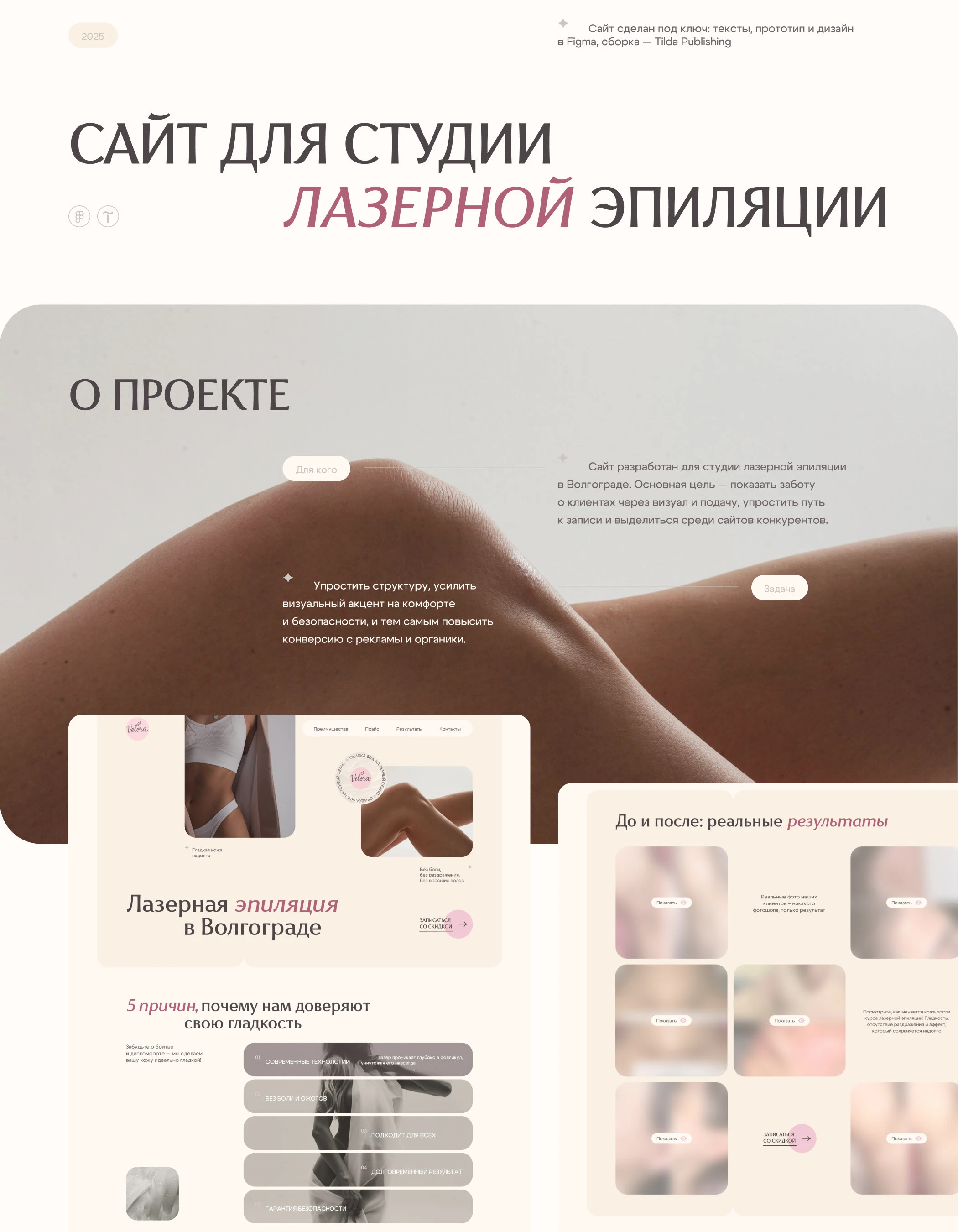 Landing page для студии лазерной эпиляции | Tilda — Изображение №1 — Интерфейсы на Dprofile