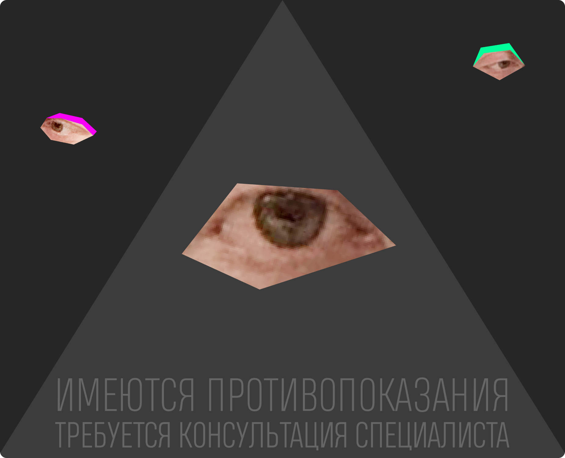 Опять попались на Dprofile