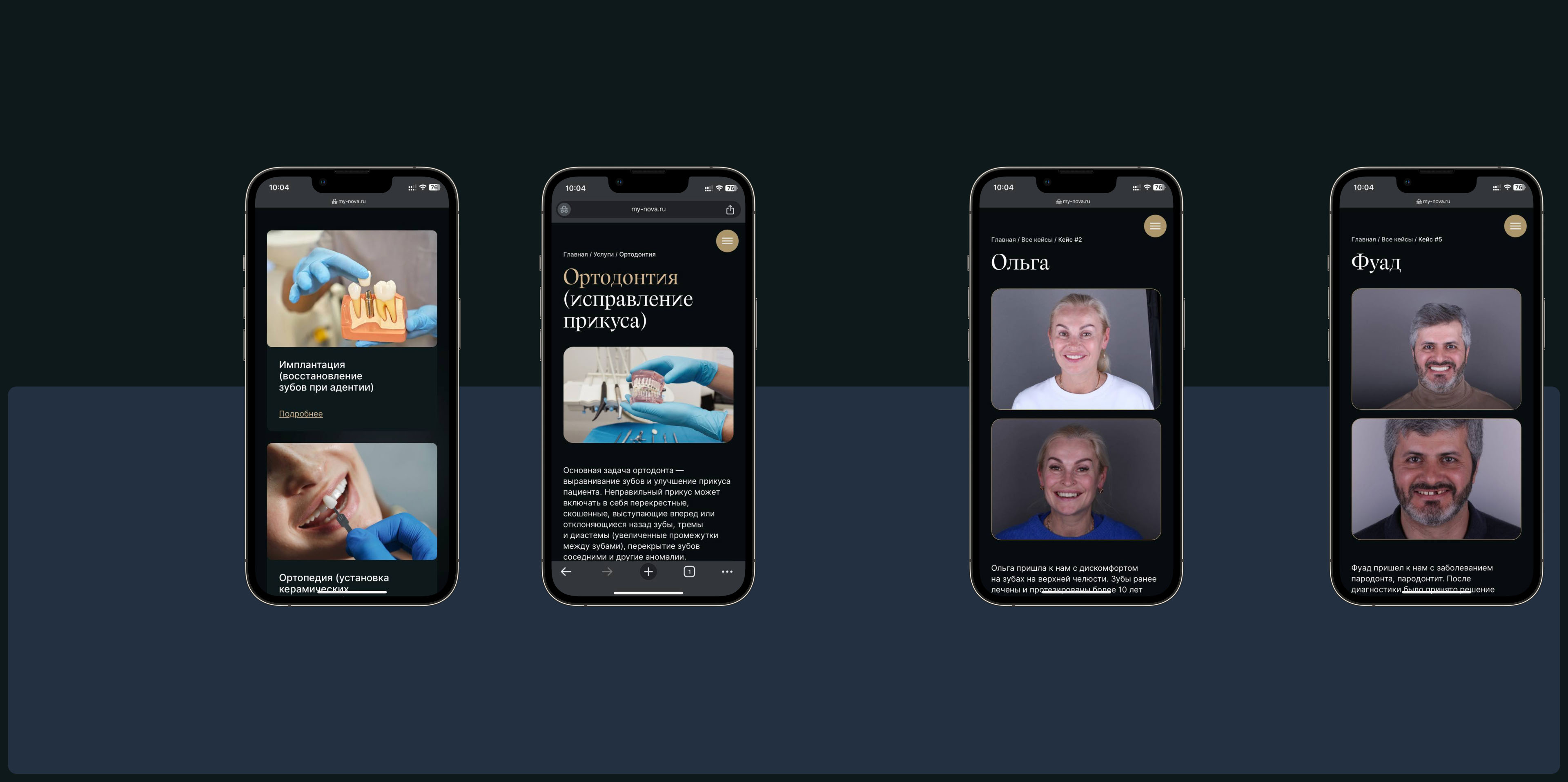Nova dental clinic — клиника стоматологии — Изображение №9 — Интерфейсы, Брендинг на Dprofile