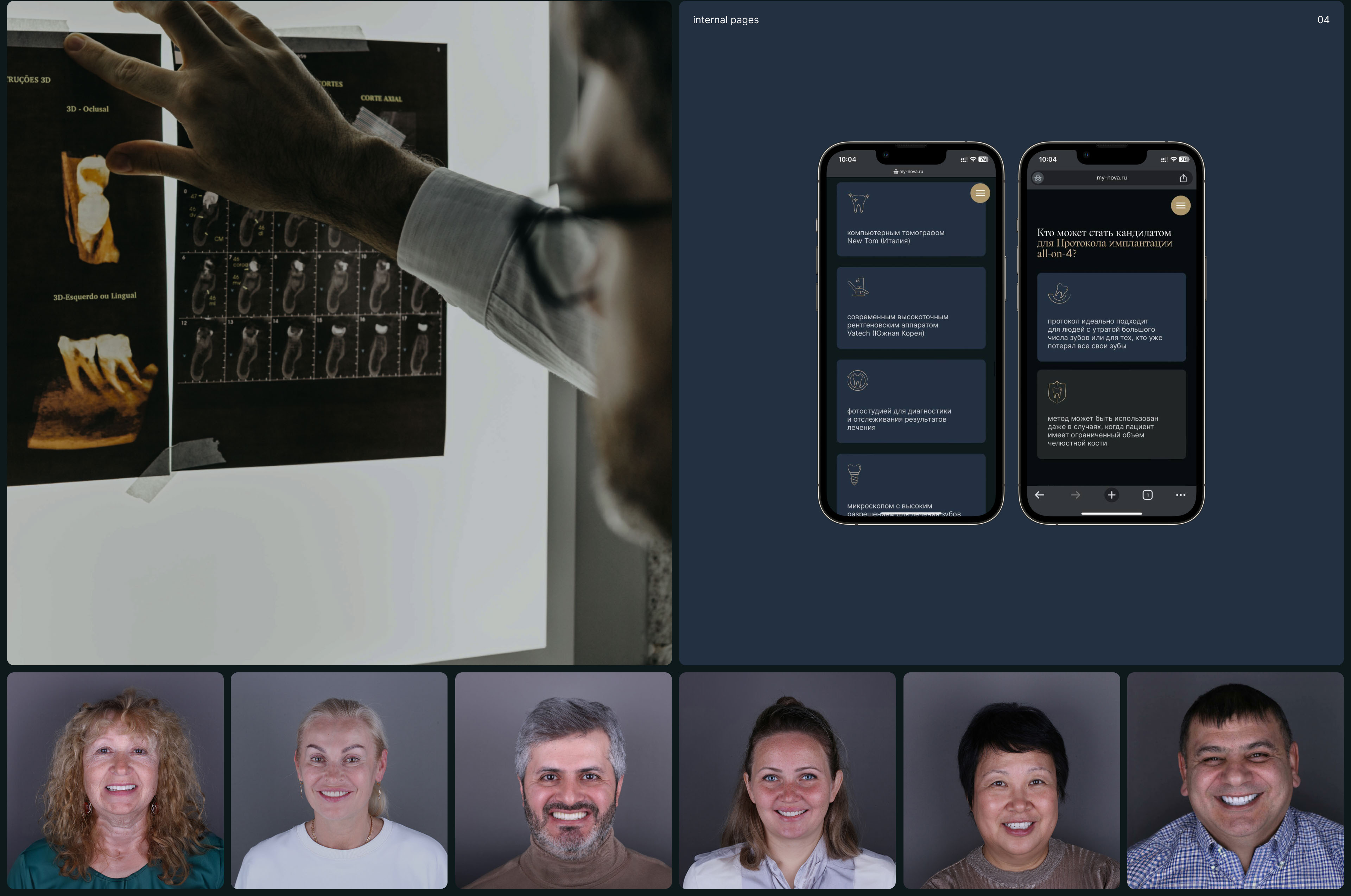 Nova dental clinic — клиника стоматологии — Изображение №10 — Интерфейсы, Брендинг на Dprofile