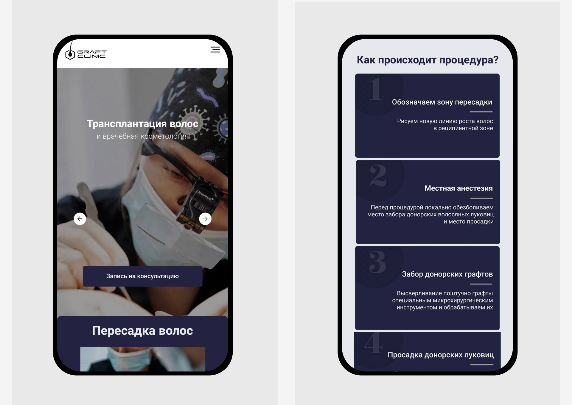 Сайт для клиники трансплантации волос — Изображение №2 — Интерфейсы на Dprofile