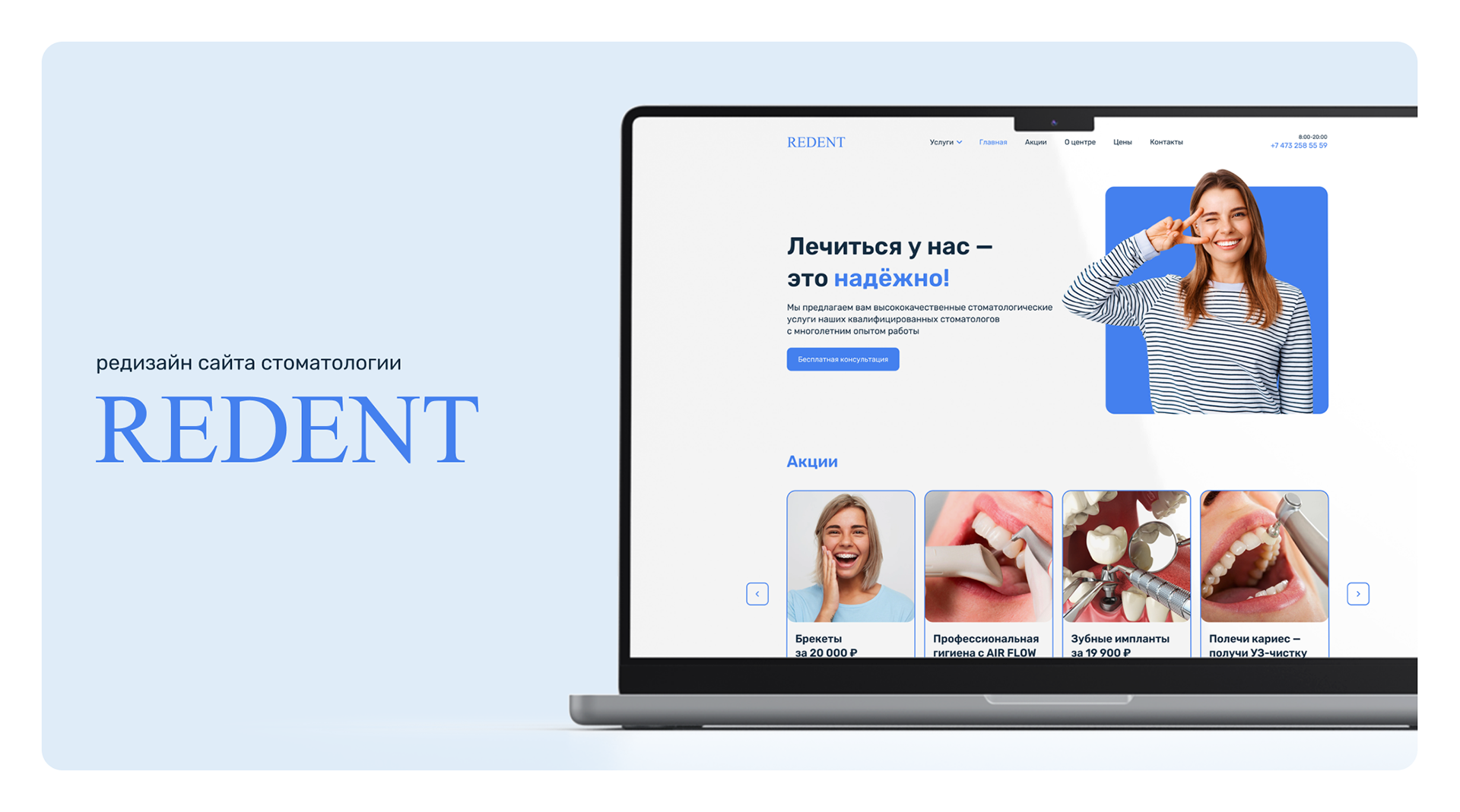 Redesign of the Redent website — Изображение №1 — Интерфейсы на Dprofile