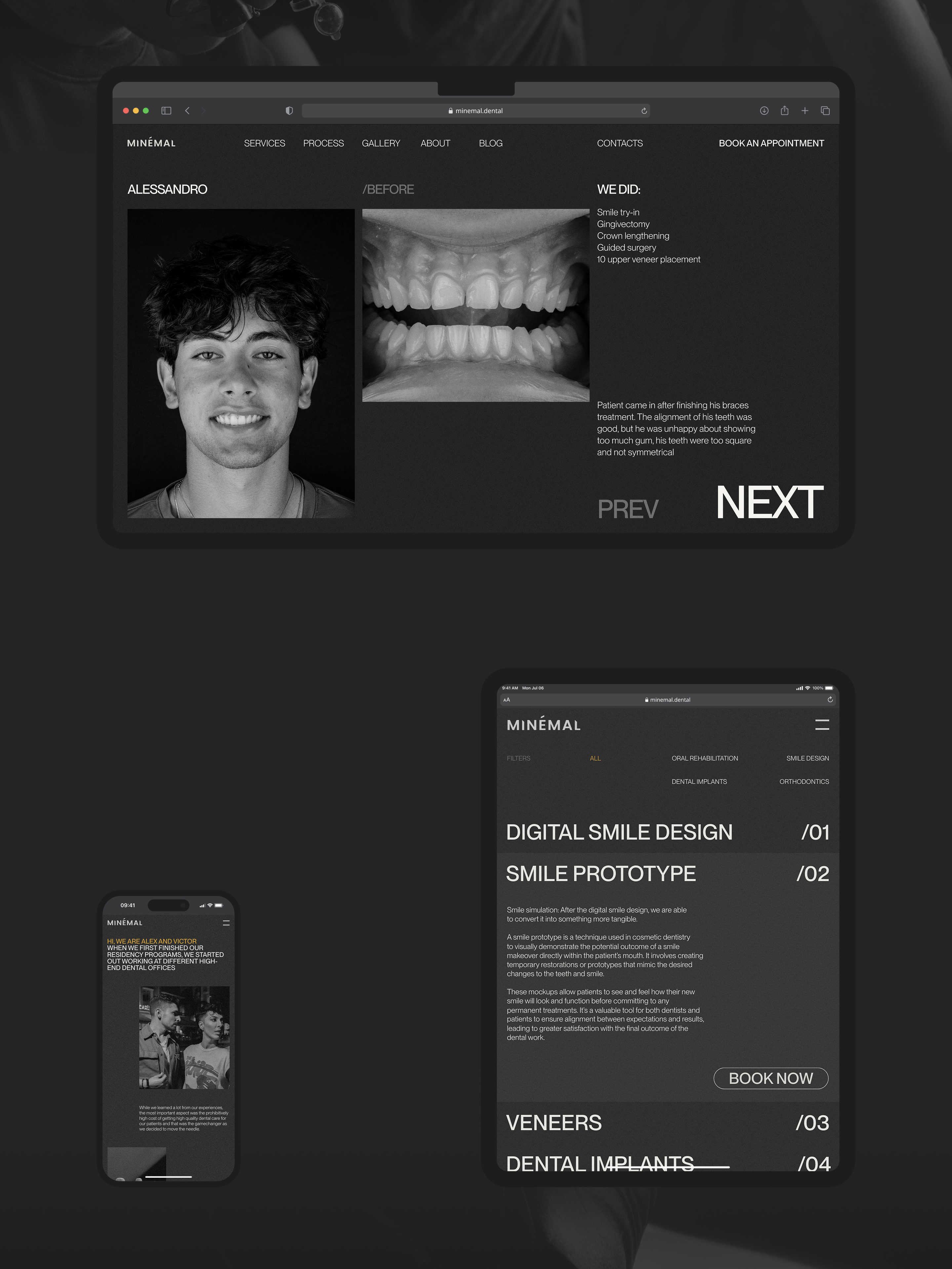 Сайт для MINÉMAL DENTAL — Изображение №10 — Интерфейсы, Брендинг на Dprofile