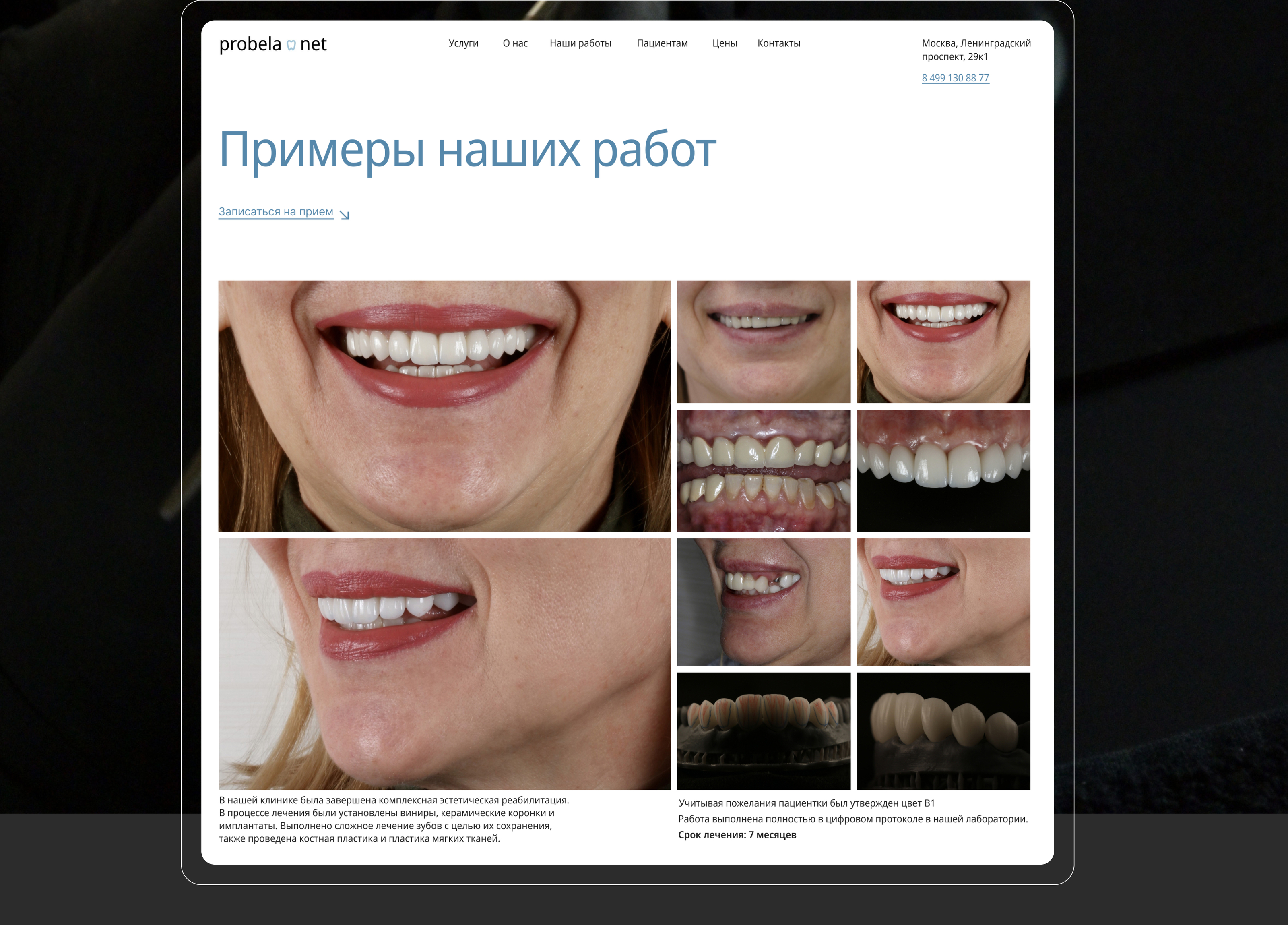 Сайт для стоматологии — Изображение №18 — Интерфейсы на Dprofile
