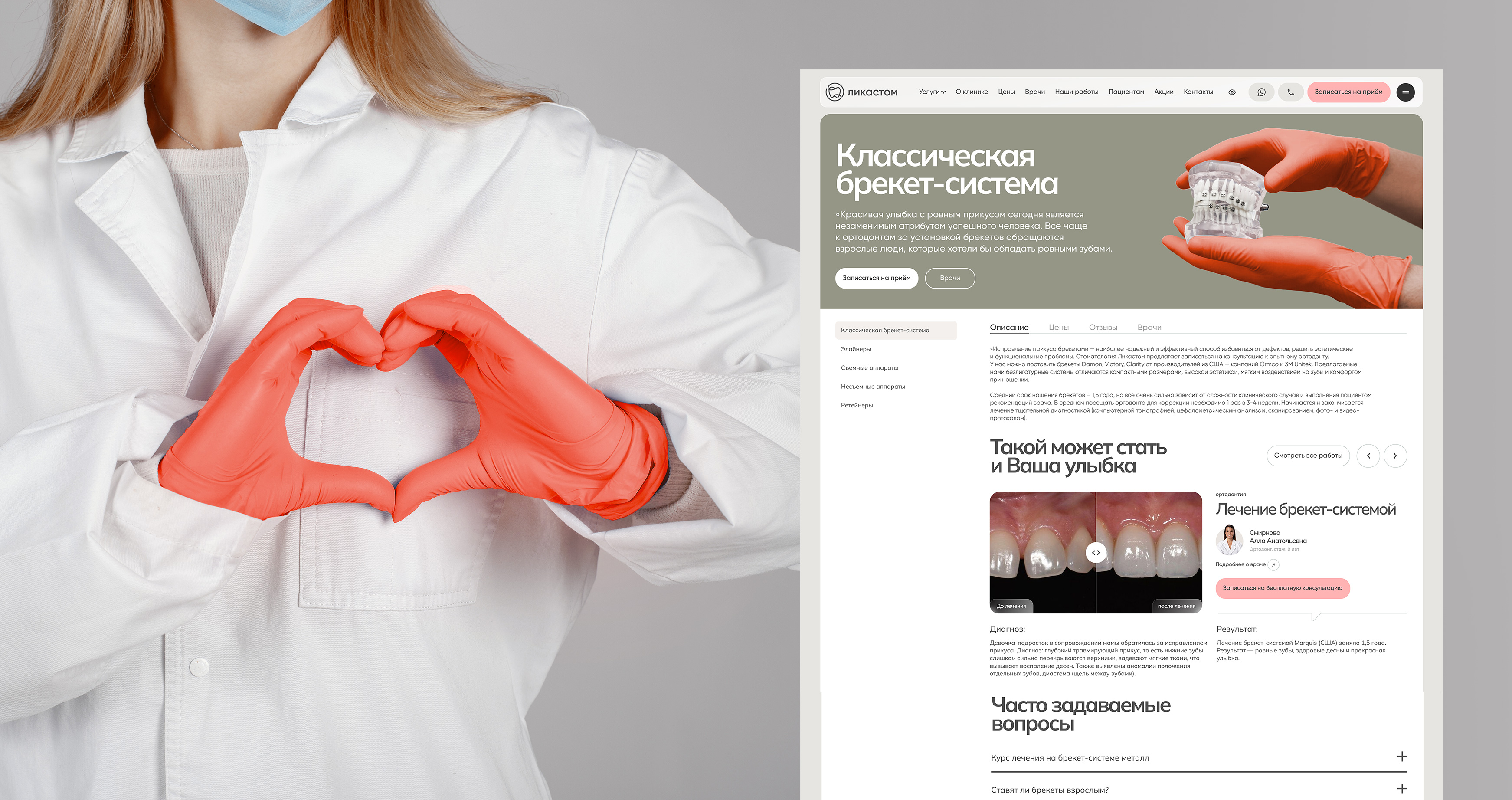 Дизайн сайта стоматологической клиники «Ликастом» — Изображение №9 — Интерфейсы на Dprofile