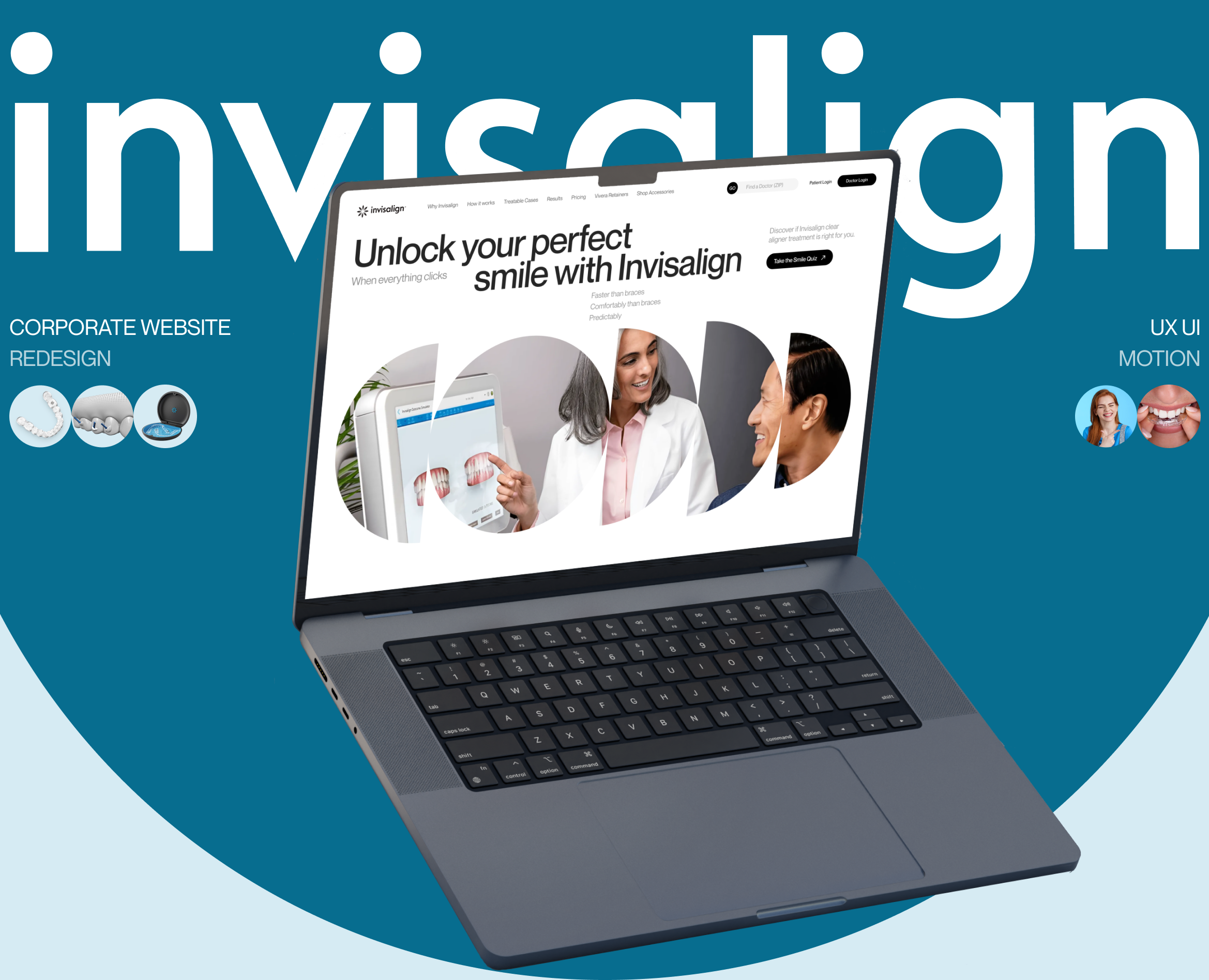Invisalign | Corporate site | Website Redesign — Интерфейсы, Анимация на Dprofile