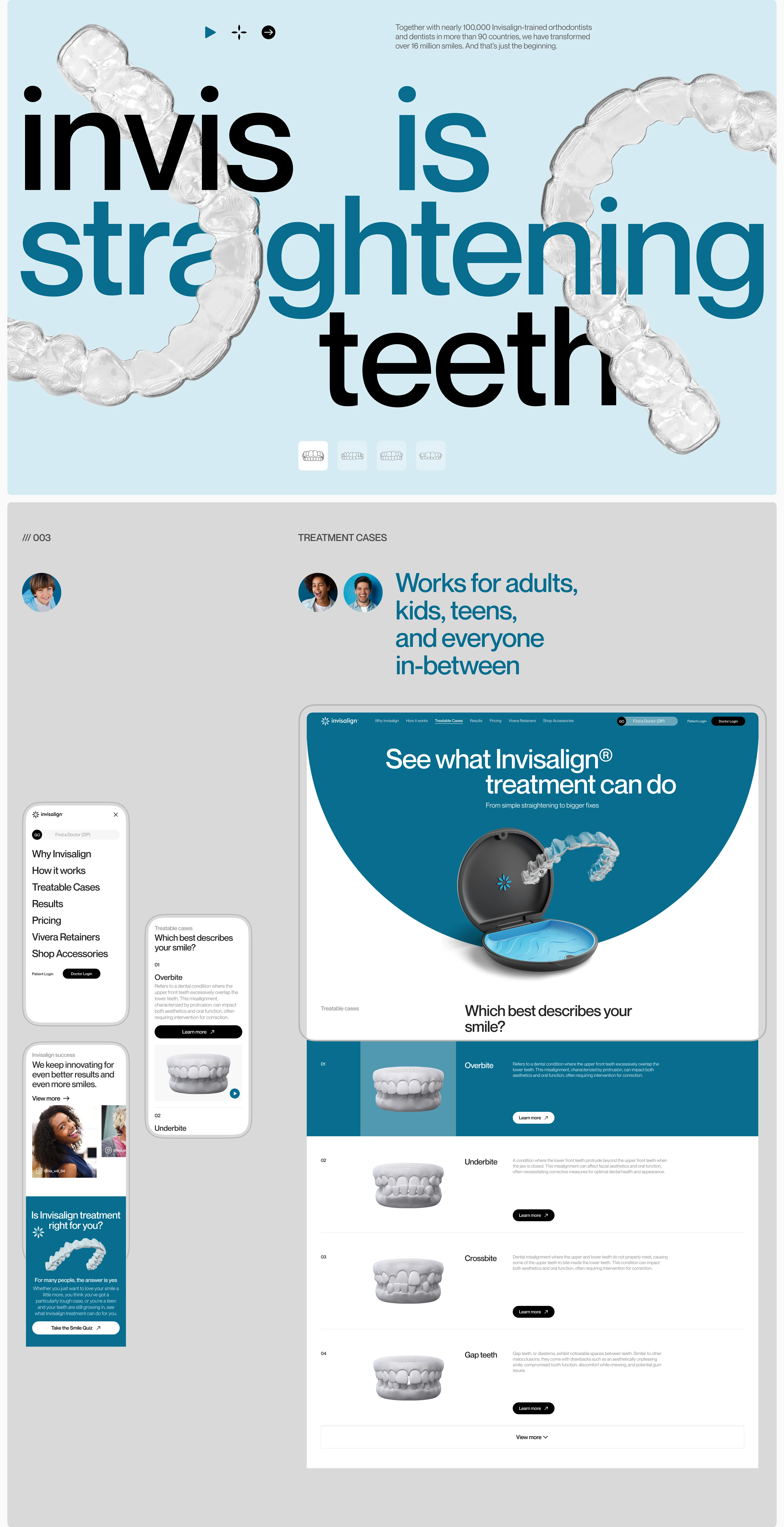 Invisalign | Corporate site | Website Redesign — Изображение №3 — Интерфейсы, Анимация на Dprofile