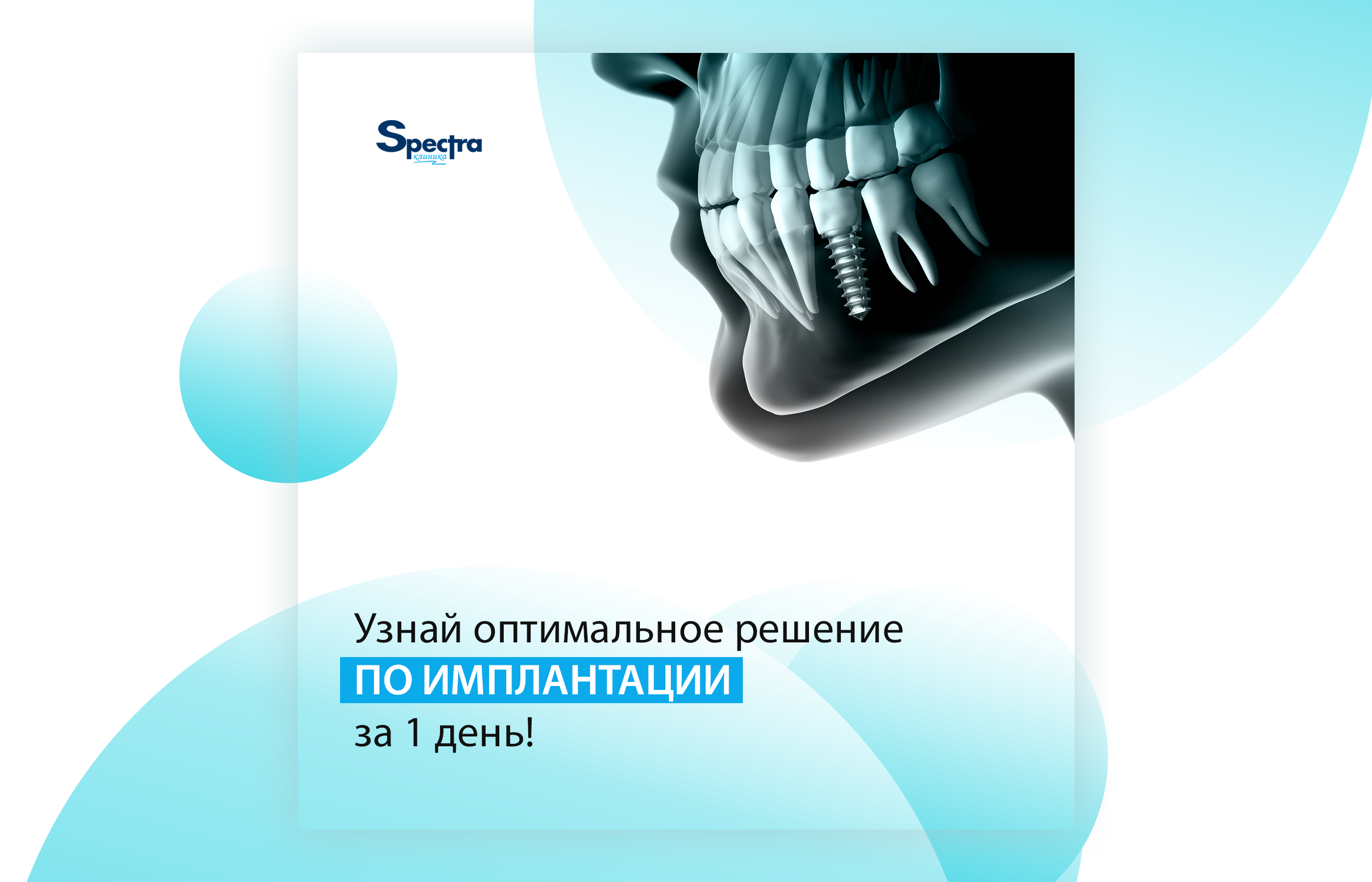 Баннеры стоматологии Dental Clinic — Изображение №3 — Маркетинг на Dprofile