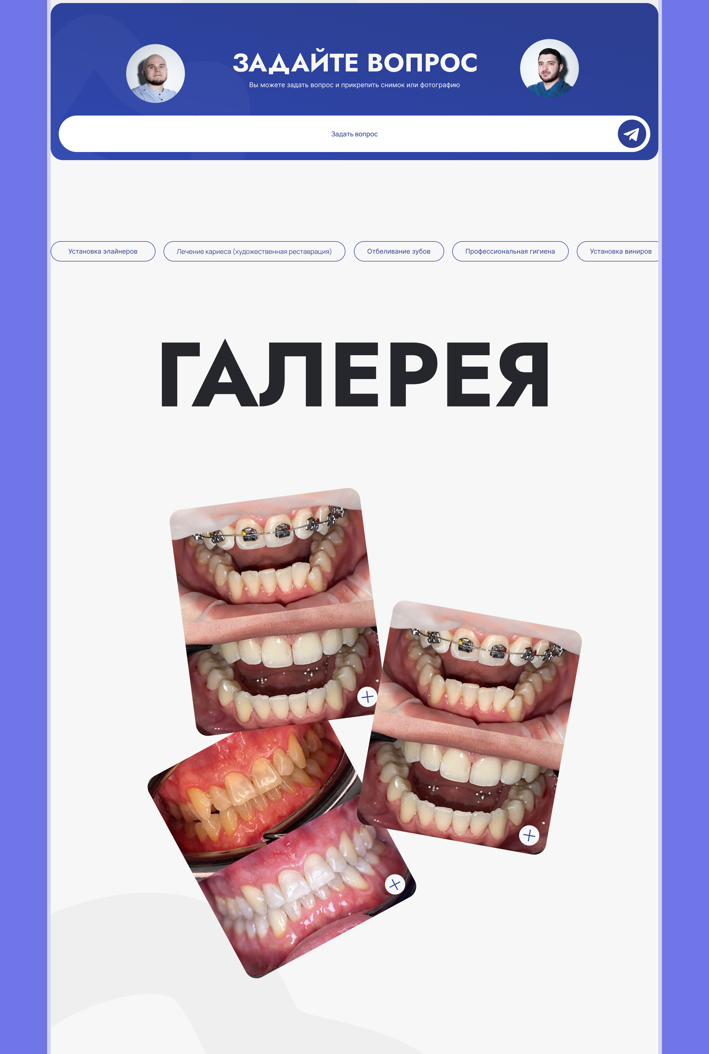 Landing page for stomatology — Изображение №9 — Интерфейсы на Dprofile