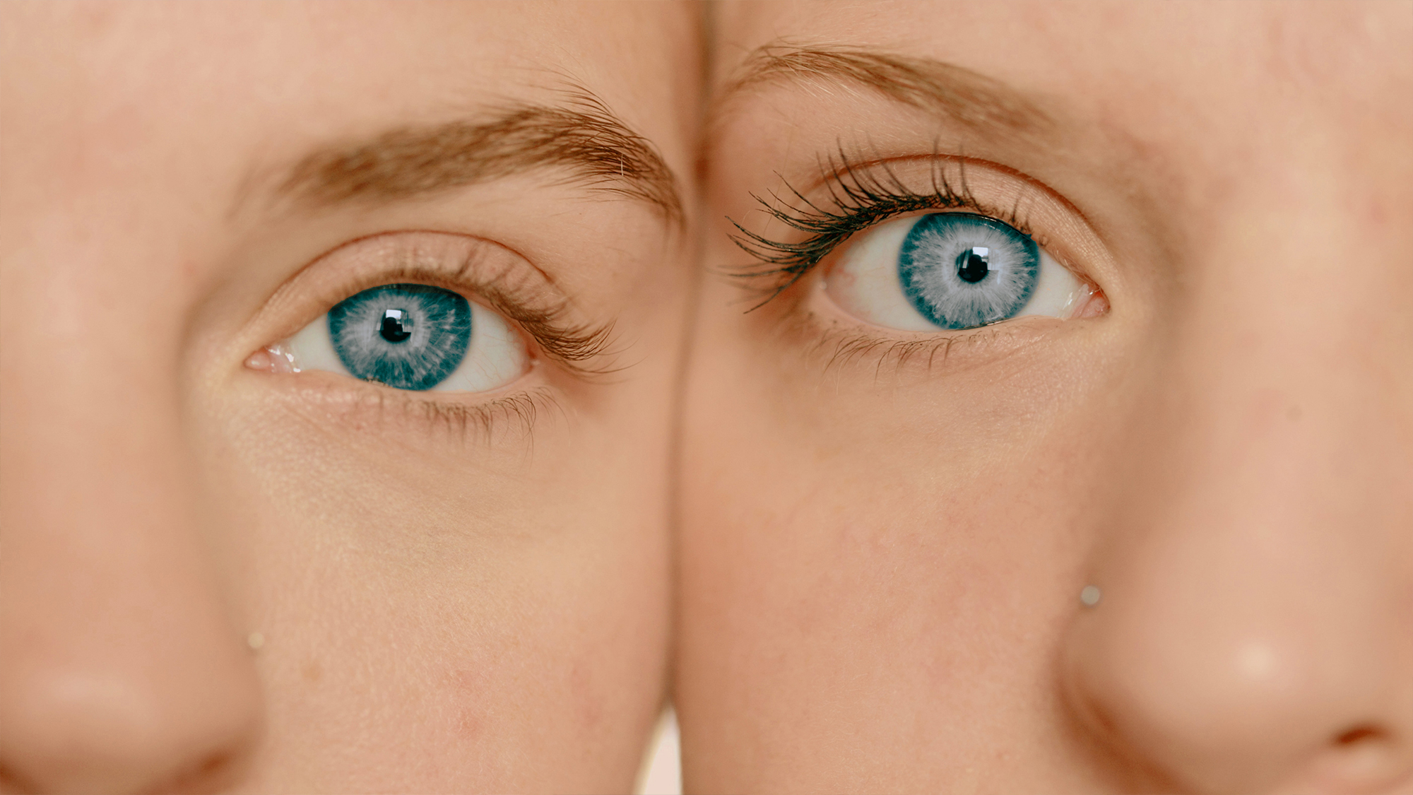 Новый бренд на московском рынке офтальмологии — Изображение №15 — Брендинг на Dprofile