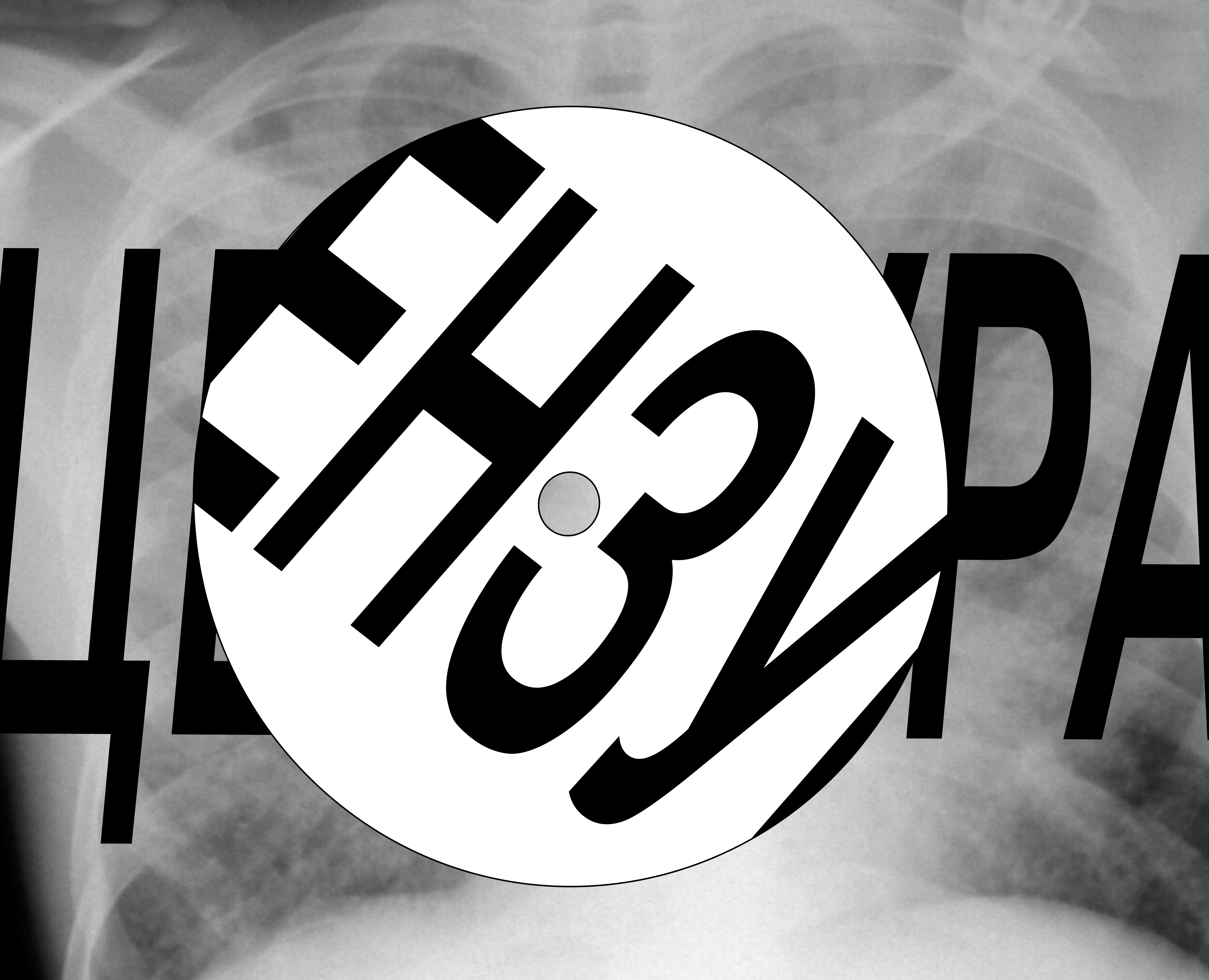 История советского рентгениздата — Интерфейсы, Анимация на Dprofile