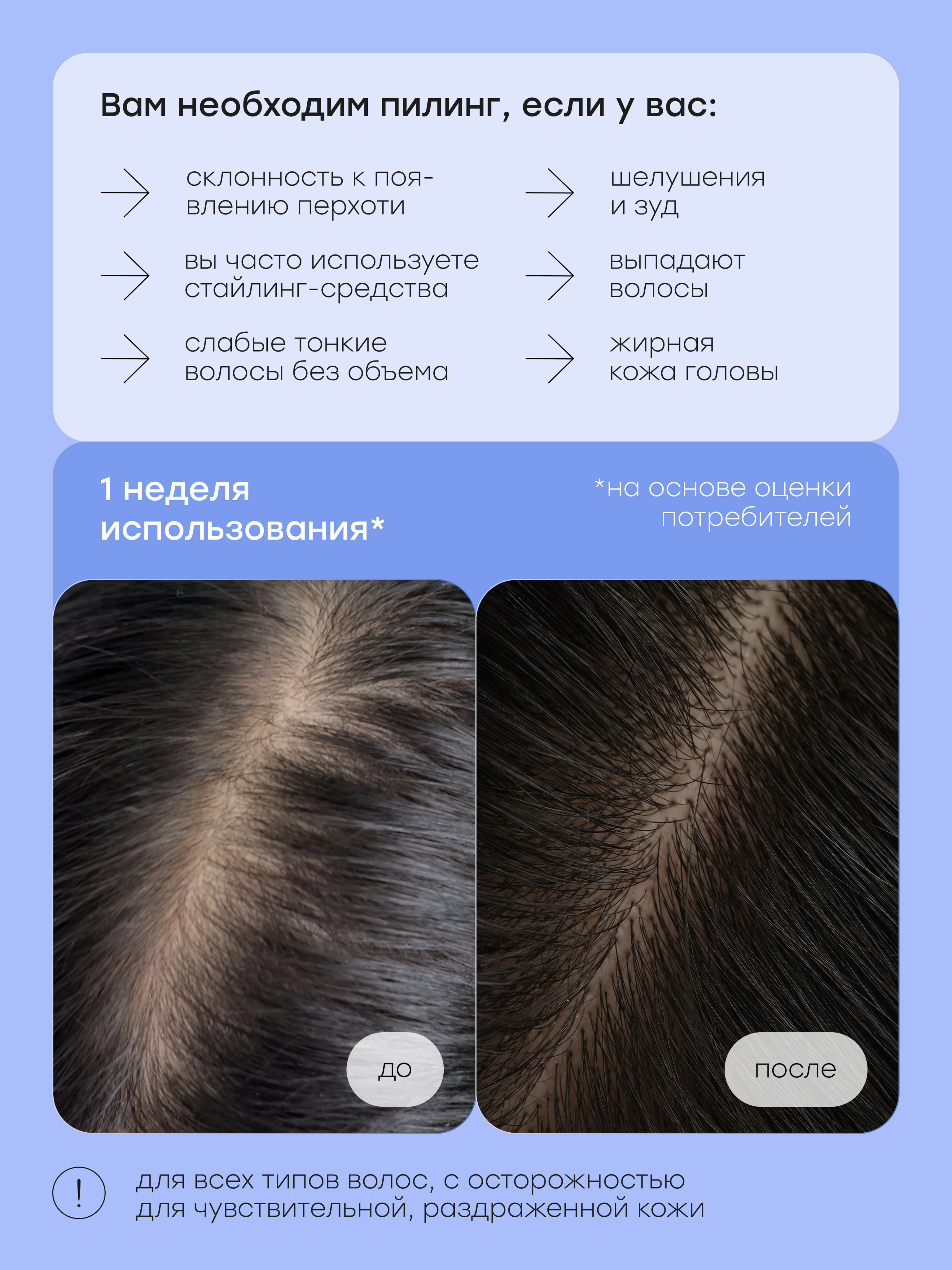 Halsa infographics — Изображение №26 — Графика, Маркетинг на Dprofile