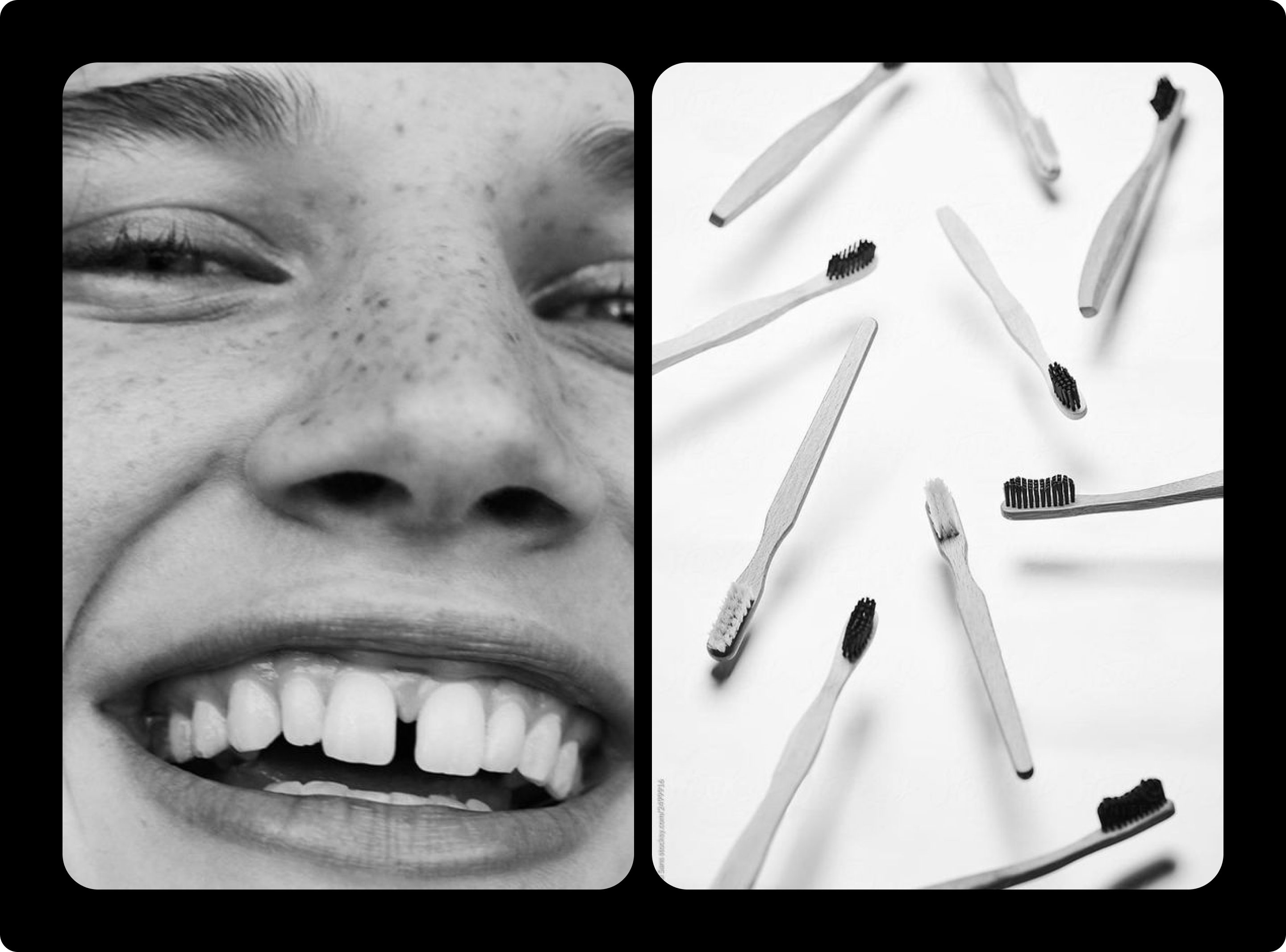 Cайт для стоматологии I Landing for Dantist Clinic — Изображение №11 — Интерфейсы на Dprofile