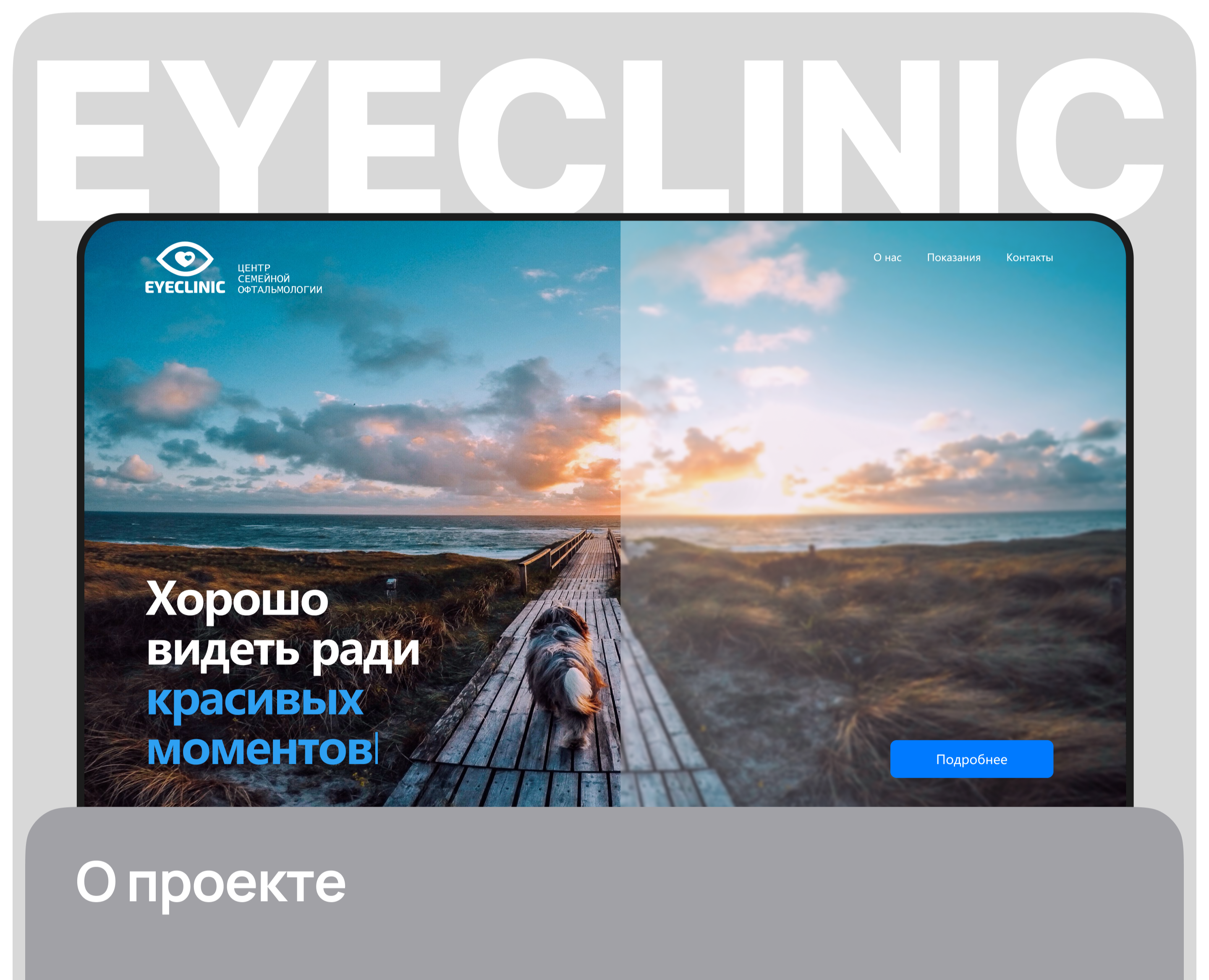 Eyeclinic, клиника коррекции зрения — Интерфейсы на Dprofile