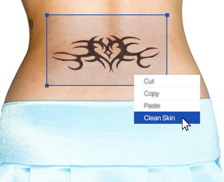 CLEAN SKIN | КЛИН СКИН | Cтудия удаления татуировок на Dprofile