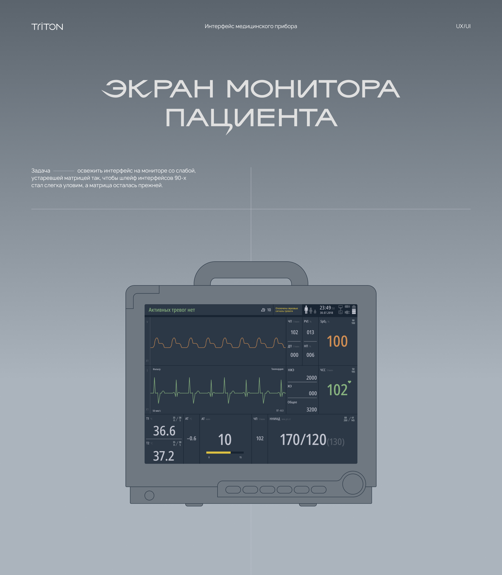 Монитор пациентов — Изображение №1 — Интерфейсы на Dprofile