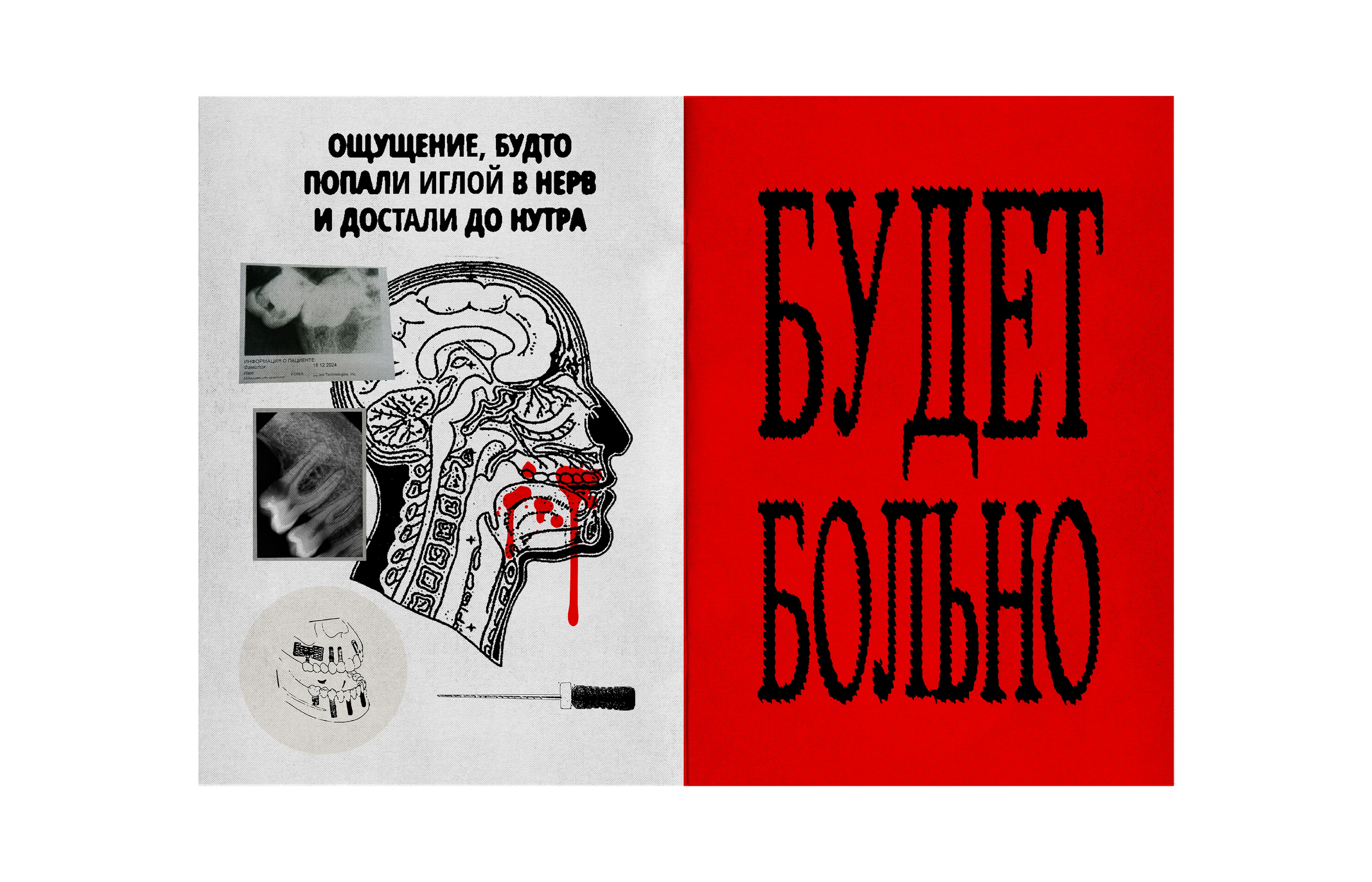 Зин «Будет больно» — Изображение №6 — Графика на Dprofile