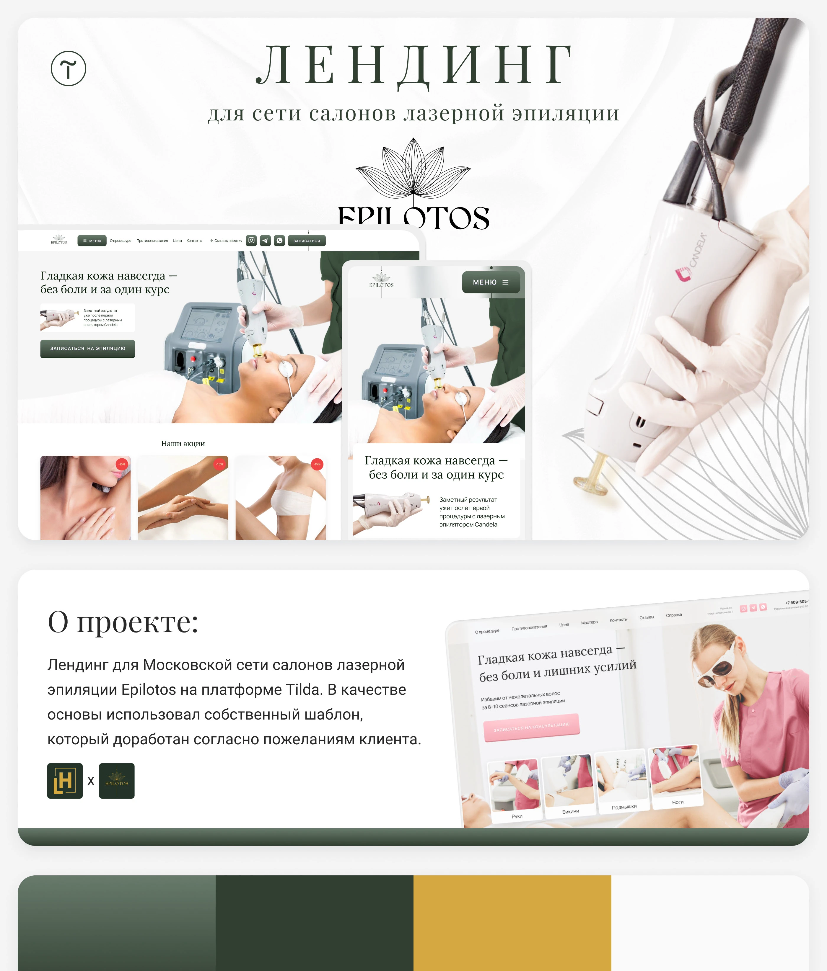 Landing для салона лазерной эпиляции — Изображение №1 — Интерфейсы на Dprofile